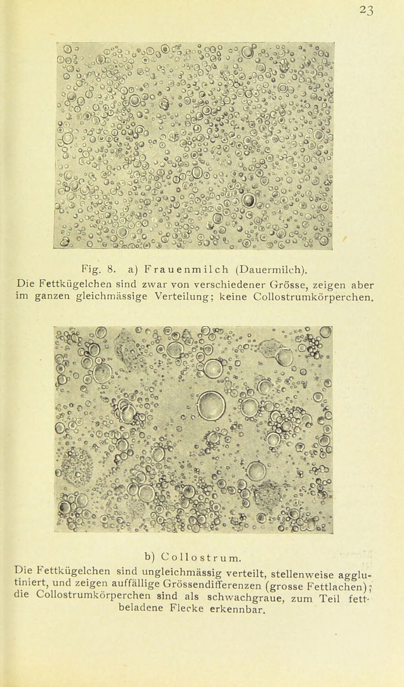 Fig. 8. a) Frauenmilch (Dauermilch). Die Fettkügelchen sind zwar von verschiedener Grösse, zeigen aber im ganzen gleichmässige Verteilung; keine Collostrumkörperchen. b) Collostrum. Die Fettkügelchen sind ungleichmässig verteilt, stellenweise agglu- tiniert, und zeigen auffällige Grössendifferenzen (grosse Fettlachen)? die Collostrumkörperchen sind als schwachgraue, zum Teil fett- beladene Flecke erkennbar.