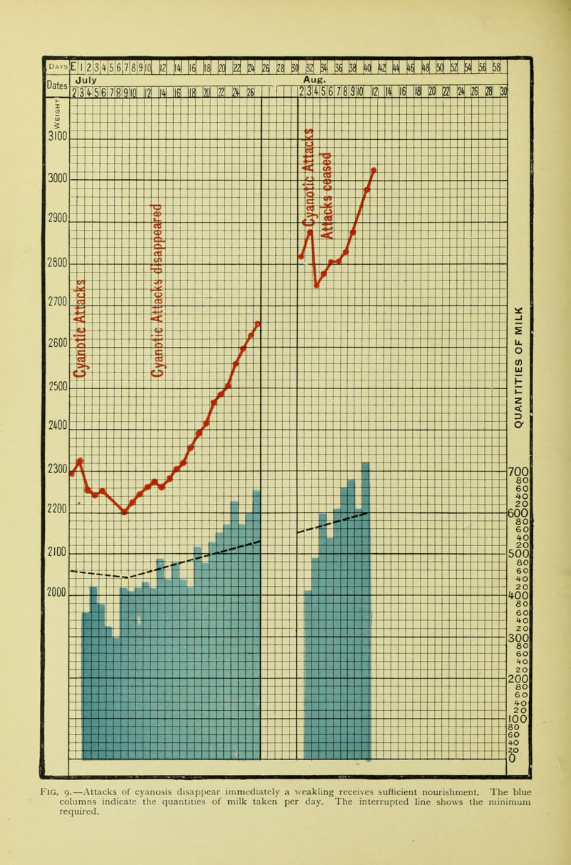 Fig. 9.—Attacks of cyanosis disappear immediately a weakling receives sufficient nourishment. The blue columns indicate the quantities of milk taken per day. The interrupted line shows the minimum required.