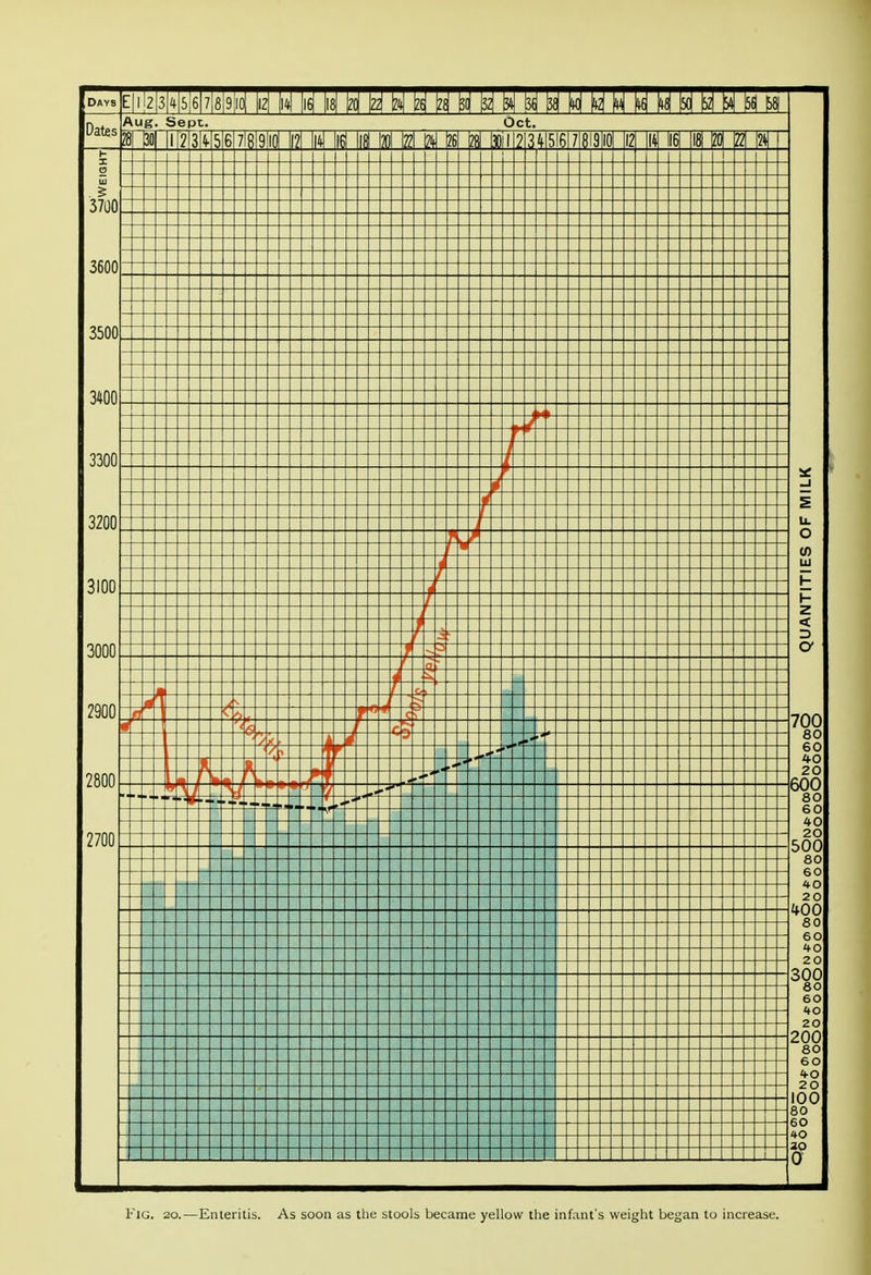 Fig. 20.—Enteritis. As soon as the stools became yellow the infant's weight began to increase.