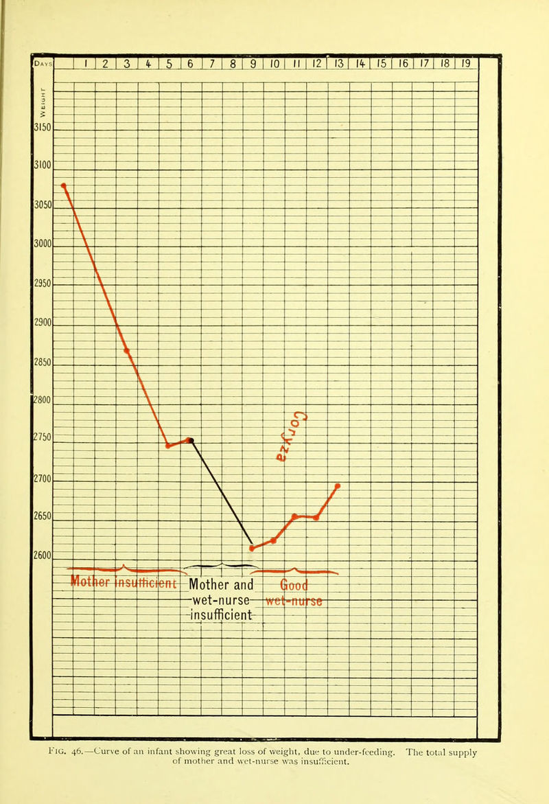 3150 3100 3050 3000 2950 2900 2850 2800 2750 2700 2650 1 1 1 2 1 3 4- 5 6 7 8 1 9 1 10 1 II 1 12 is I't-I 15 1 16 17 18 1 19 -A r— / 4 4 —1 et-nurs o 114+1 r» 1 /\ id- ( lOO( w e— -ntr rue- 2600 l'lG. 46.—Curve of an infant showing great loss of weight, due to under-feeding of mother and wet-nurse was insufficient. The total supply