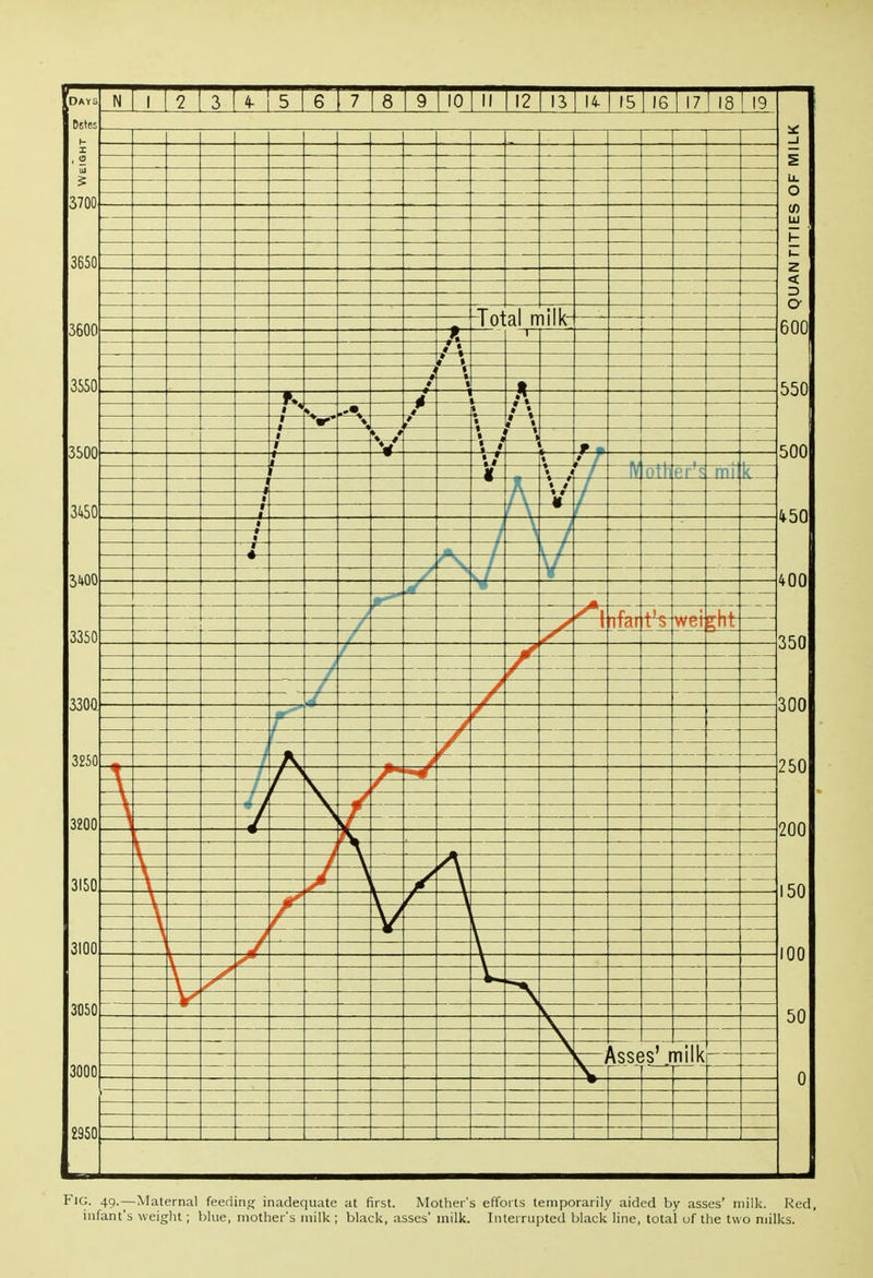 Fig. 49.—Maternal feeding inadequate at first. Mother's efforts temporarily aided by asses' milk. Red, infant's weight; V)lue, mother's milk ; black, asses' milk. Interrupted black line, total uf the two milks.
