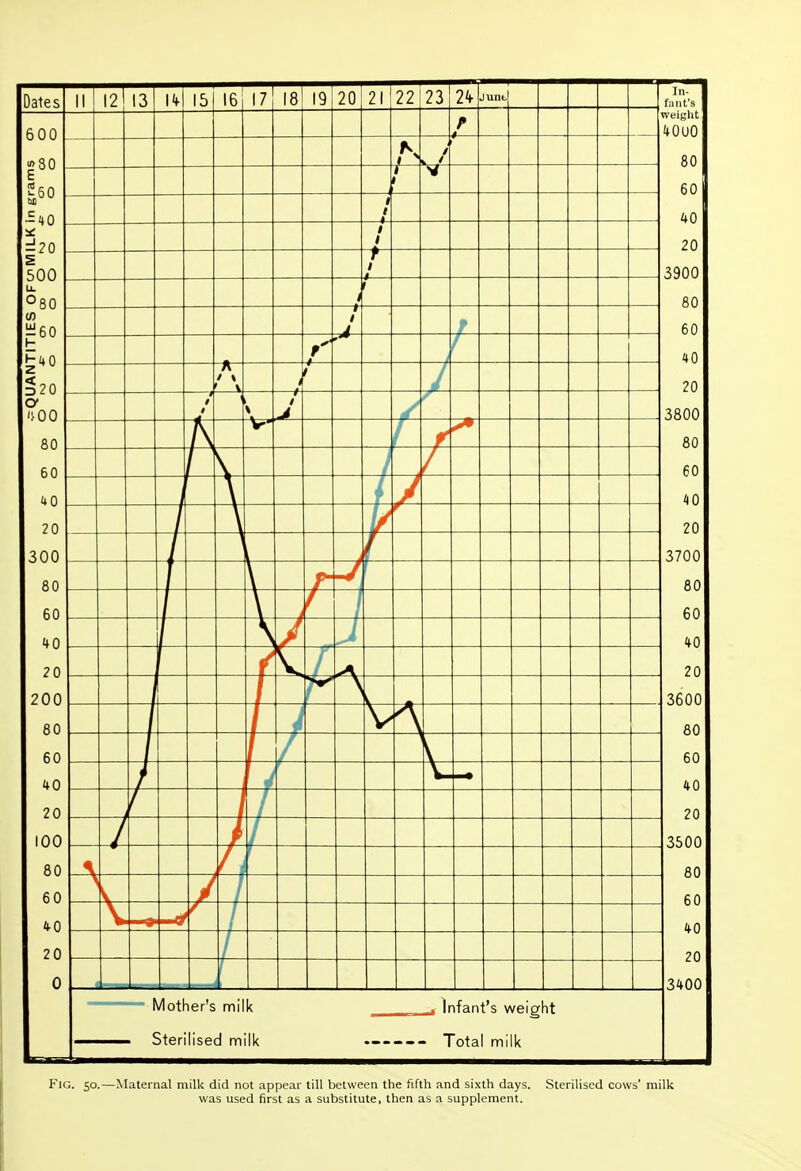 Fig. 50.—Maternal milk did not appear till between the fifth and sixth days. Sterilised cows' milk was used first as a substitute, then as a supplement.