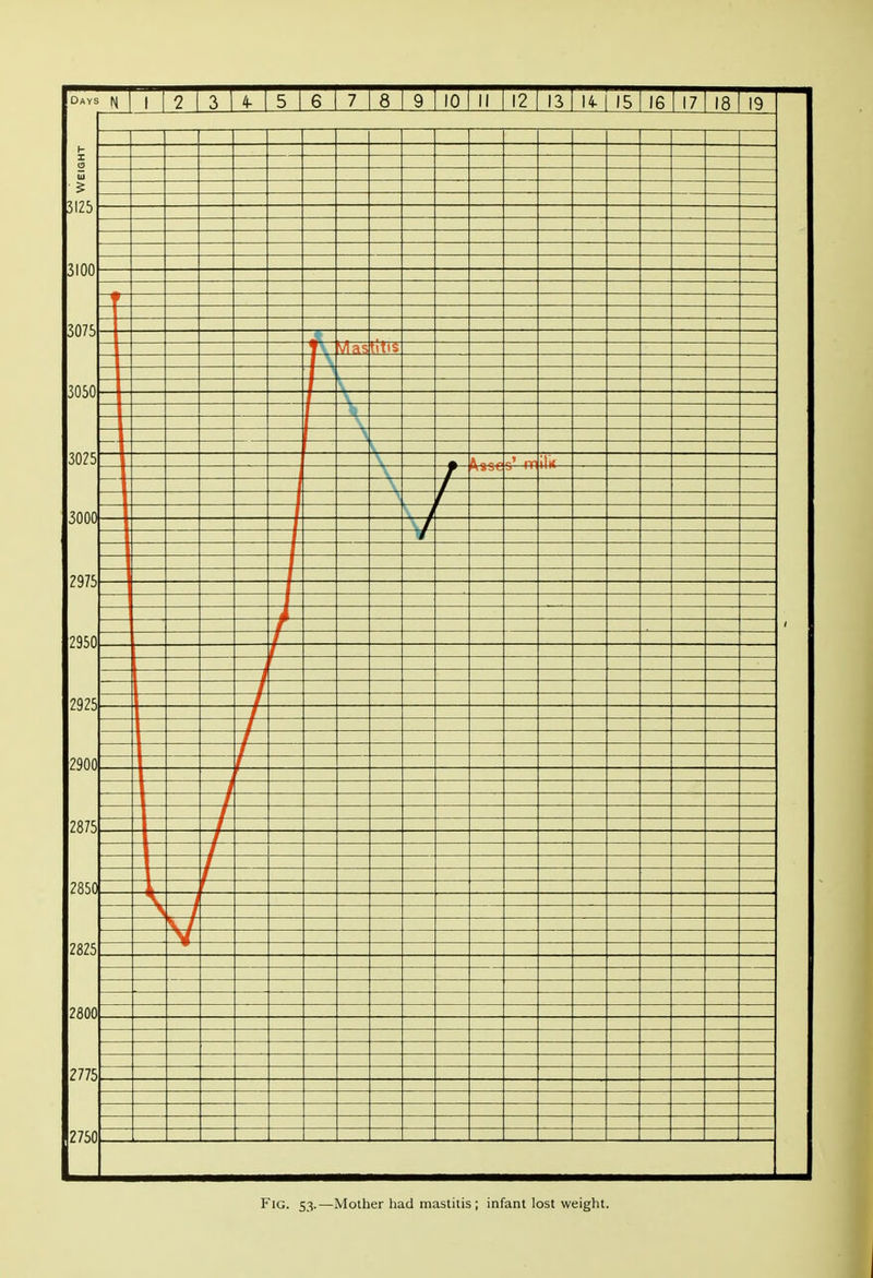 Fig. S3-—Mother had mastitis; infant lost weight.