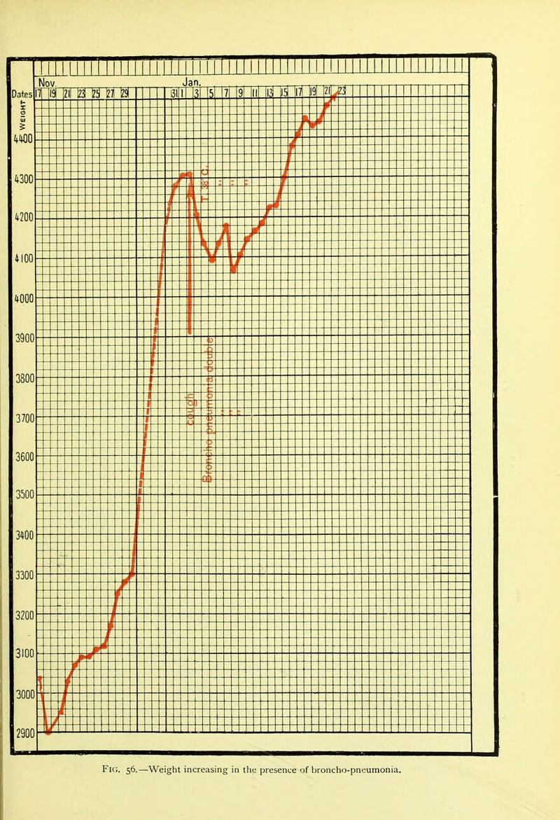 Fk;. 56.—Weight increasing in the presence of broncho-pneumonia.