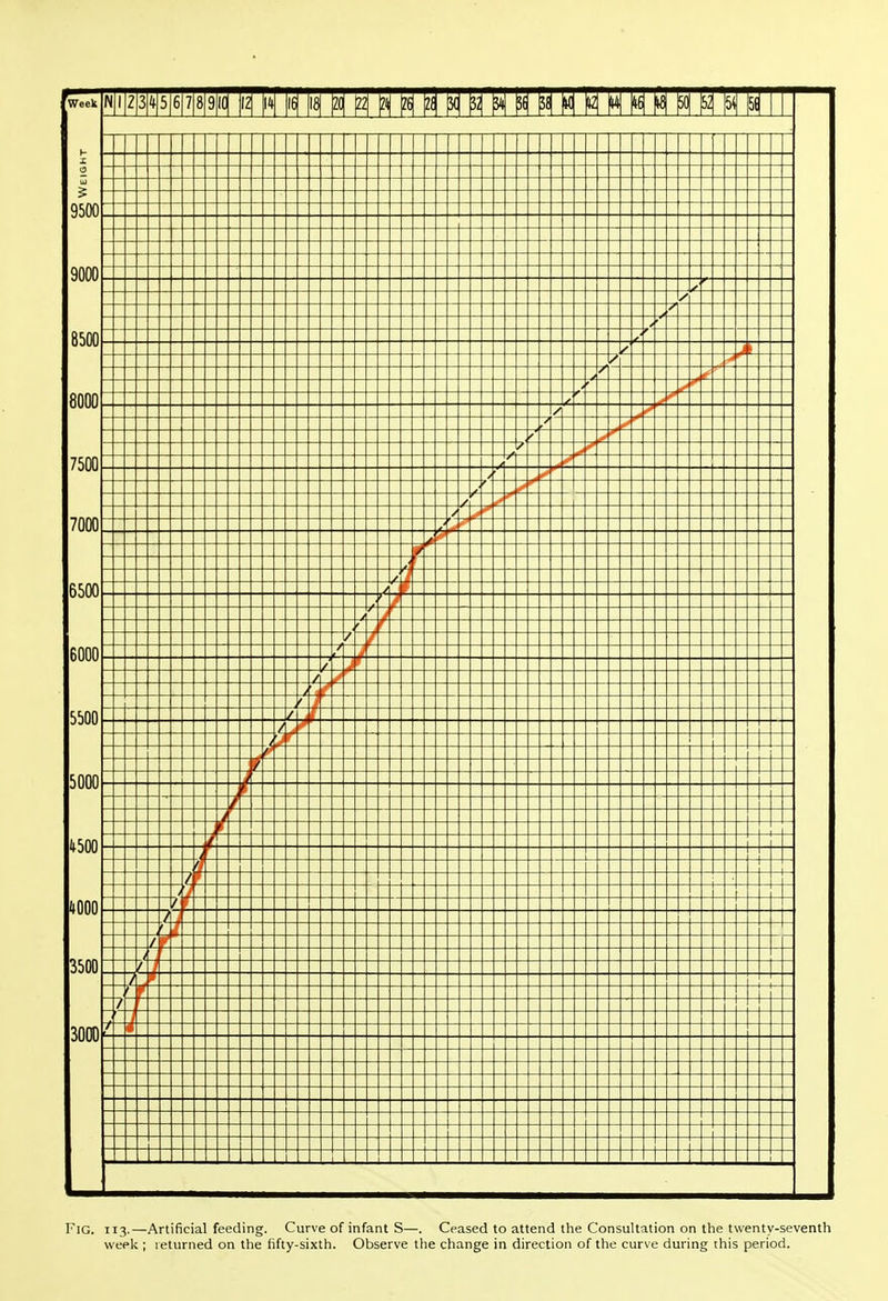 Fig. 113.—Artificial feeding. Curve of infant S—. Ceased to attend the Consultation on the twenty-seventh week ; returned on the fifty-sixth. Observe the change in direction of the curve during this period.