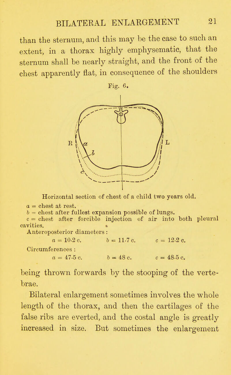 than the sternum, and this may be the case to sucli an extent, in a thorax highly emphysematic, that the sternum shall be nearly straight, and the front of the chest apparently flat, in consequence of the shoulders Fig. 6. Horizontal section of chest of a child two years old. o = chest at rest. b = chest after fullest expansion possible of lungs, c = chest after forcible injection of air into both pleural cavities. • Anteroposterior diameters: a = 10.2 c. 6 = 11.7 c. c= 12.2 c. Circumferences : a = 47-5 c. 6 = 48 c. c = 48-5 c. being thrown forwards by the stooping of the verte- brae. Bilateral enlargement sometimes involves the whole length of the thorax, and then the cartilages of the false ribs are everted, and the costal angle is greatly increased in size. But sometimes the enlargement