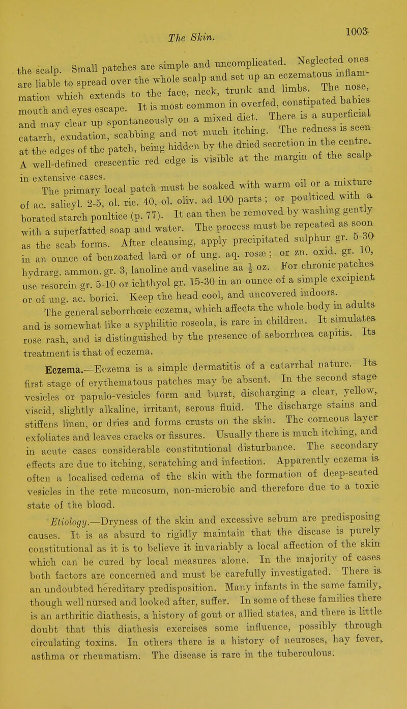 Ike SUn. the scalp Small patches are simple and uncomplicated. Neglected ones :t to spread over the whole scalp and set up an e--tous S^^^^^ --7 wHeh extends ;oronr:verTel ^nsJipald ^ Zt:;^^:^.::::^: . There is a ^r^c.. catarrh, exudation, scabbing and not much i chmg. Tie redness sjen at the edges of the patch, being hidden by the 'i™^^^'*^ of tL scalp A well-deftned cresceutic red edge is visible at the margm of the scalp in extensive cases. , , -i o rv^W+nrp- The primary local patch must be soaked with warm oil or a mixture of ac salicyl. 2-5, ol. ric. 40, ol. oliv. ad 100 parts; or poulticed with a. borated starch poultice (p. 77). It can then be removed by washing gently .vith a superfatted soap and water. The process must be repeated as soon as the scab forms. After cleansing, apply precipitated sulphur gr. 5-dO in an ounce of benzoated lard or of ung. aq^rosee ; or zn oxid. gr iu, hvdrarg. ammon. gr. 3, lanoline and vaseline aa J oz. For chronic patches, use resorcin gr. 5-10 or ichthyol gr. 15-30 in an ounce of a simple excipient or of uno-. ac. borici. Keep the head cool, and uncovered mdoors. The general seborrhoeic eczema, which affects the whole body m adults and is somewhat like a syphilitic roseola, is rare in children. It simulates rose rash, and is distinguished by the presence of s.eborrhoea capitis, its treatment is that of eczema. Eczema.—Eczema is a simple dermatitis of a catarrhal nature. Its first stage of erythematous patches may be absent. In the second stage vesicles °or papulo-vesicles form and burst, discharging a clear, yellow viscid, slightly alkaline, irritant, serous fluid. The discharge stams and stifiens linen, or dries and forms crusts on the skin. The corneous layer exfoliates and leaves cracks or fissures. Usually there is much itchmg, and in acute cases considerable constittitional disturbance. The secondary effects are due to itching, scratching and infection. Apparently eczema is often a localised oedema of the skin with the formation of deep-seated vesicles in the rete mucosum, non-microbic and therefore due to a toxic state of the blood. Etiology.—'Dxjness of the skin and excessive sebum are predisposing causes. It is as absurd to rigidly maintain that the disease is purely constitutional as it is to believe it invariably a local affection of the skm which can be cured by local measures alone. In the majority of cases both factors arc concerned and must be carefully investigated. There is- an undoubted hereditary predisposition. Many infants in the same family, though well nursed and looked after, suffer. In some of these families there is an arthritic diathesis, a history of gout or allied states, and there is little doubt that this diathesis exercises some influence, possibly through circulating toxins. In others there is a history of neuroses, hay fever,, asthma or rheumatism. The disease is rare in the tuberculous.