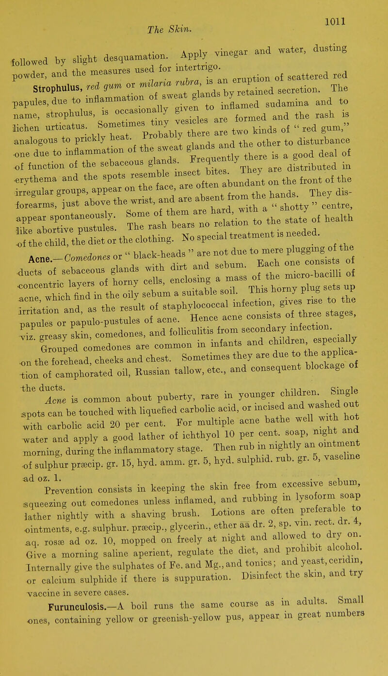 feUowed by sligM des,ua:nation. Apply vinegar and water, dustmg powder, and the measnres used for ■ntertr.go^ Strophulus, rei or '^^J,; ' secretion. The papules, due to inflanamation of s weat glands by ^^^^^^^ Jiohen nrfcatus. „e two kinds of red gum. analogous to prickly heat. rtobaOly t disturbance .one due to inflammation of the sweat gl^^ ™^ , i deal of of function of the sebaceous glands. '.^a stributed in ,.ythema and the spots ^'11^^^^^'' ^^^J^^^^ ;rrrs,«;r:brrwrt;^ rr:i~ot;r t\he .j. .... ,oHhe cMd. the diet or the clothing. No special treatment .s needed. ^ J  hi« heads '' are not due to mere plugging ot tHe Acne.-Comedones or ^ack lieads a ^^^^.^^^ •ducts of sebaceous glands with dirt and seDum. ^;,ro-bacilli of concentric layers of horny c^K J^tis^^ a one which find in the oily sebum a suitable soil. Ihis norny P _ ^ ^ -2tt and, as the result of ^^^^^ -g^ rgt:;scr:s^^^^^^^^^^^^ Srped comedones are common in infants and .on the forehead, cheeks and chest. Sometimes they are due to t^e applu^a -tion of camphorated oil, Russian tallow, etc.. and consequent blockage ''^'Icte is common about puberty, rare in younger fld-n. S^^^^^^ .pots can be touched with liquefied carbolic acid, or mcised and washed out wxth carbolic acid 20 per cent. For multiple acne bathe well wr^h hot ^ater and apply a good lather of ichthyol 10 per cent, soap, night and Torlg durmg'ttelflammatory stage. Then rub in nightly an omtmen Tf sulph;r pr Jp. gr. 15, hyd. amm. gr. 5, hyd. sulphid. rub. gr. 5. vaseline 'prevention consists in keeping the skin free from excessive sebum, squeezing out comedones unless inflamed, and rubbing m lysoform soap lather nightly with a shaving brush. Lotions are often preferable to •ointments, e.g. sulphur, pr^ecip., glycerin., ether aa dr. 2, sp. vm. rect. dr. i ^q. rosee ad oz. 10, mopped on freely at night and allowed to dry on Give a morning saline aperient, regulate the diet, and prohibit alcohol. Internally give the sulphates of Fe. and Mg., and tonics; and yeast, ceridm, or calcium sulphide if there is suppuration. Disinfect the skm. and try vaccine in severe cases. Furunculosis.-A boil runs the same course as in adults. Small ones, containing yellow or greenish-yellow pus, appear in great numbers