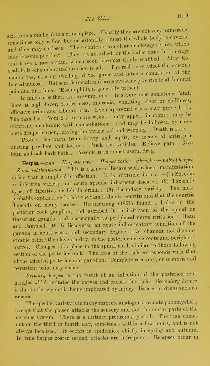 .ize from a pin head to a crown piece. Usually they are not very numerous Im Ws only a few, but occasionally almost the whole body is cove ed r.rv mav coalesce Their contents are clear or cloudy serum, which ■ They are absorbed, or the bullae burst in 1. days .Jleave a raw surface wh.h --^''TZ ^^^^^^ scab falls off some discolouration is left. iHe rasa may ai embrane, causing swelling of the gums and intense congestion of the Wal mucosa. Bull, in the small and large intestine give rise to abdominal pain and diarrhcea. Bosinophilia is generally present. ^ In mild cases there are no symptoms. In severe ones, sometime fatal, there is high fever, restlessness, anorexia, vomiting, rigor or chillmes , ofiensive urine and albuminuria. Even apyrexial cases may prove fatal. The rash lasts from 2-7 or more weeks ; may appear m crops ; may be recurrent, or chronic with exacerbations ; and may be followed by com- plete desquamation, leaving the cuticle red and weepmg. Death is rare Protect the parts from injury and sepsis, by means of antiseptic dusting powders and lotions. Prick the vesicles. Believe pam. Give bran and oak bark baths. Arsenic is the most useful drug. Rems.-Syn. : Herpetic fever— Herpes zoster-Shingles— Labial herpes -Zona ophthalmicus.-This is a general disease with a local manifestation rather than a simple skin affection. It is divisible into a :-(!) Specific or infective variety, an acute specific infectious disease ; (2) Toxismic type, of digestive or febrile origin ; (3) Secondary variety. The most probable explanation is that the rash is due to neuritis and that the neuritis depends on many causes. Barensprung (1861) found a lesion m the posterior root ganglion, and ascribed it to irritation of the spinal or ■Gasserian ganglia, and occasionally to peripheral nerve irritation. Head and Campbell (1900) discovered an acute inflammatory condition of the ganglia in acute cases, and secondary degenerative changes, not demon- strable before the eleventh day, in the posterior nerve roots and peripheral nerves. Changes take place in the spinal cord, similar to those following section of the posterior root. The area of the rash corresponds with that •of the affected posterior root ganglion. Complete recovery, or sclerosis and persistent pain, may ensue. Primary) herpes is the result of an infection of the posterior root ganglia which irritates the nerves and causes the rash. Secondary herpes is due to these ganglia being implicated by injury, disease, or drugs such as arsenic. The specific variety is in many respects analogous to acute poliomyelitis, ■except that the poison attacks the sensory and not the motor parts of the nervous system. There is a distinct prodromal period. The rash comes out on the third or fourth day, sometimes within a few hours, and is not always localised. It occurs in epidemics, chiefly in spring and autumn. In true herpes zoster second attacks are infrequent. Relapses occur in