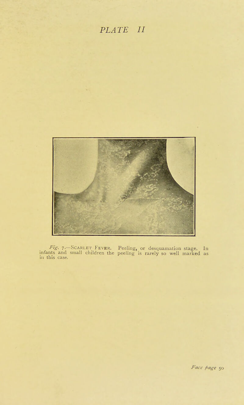 PLATE II Face f>ag^e