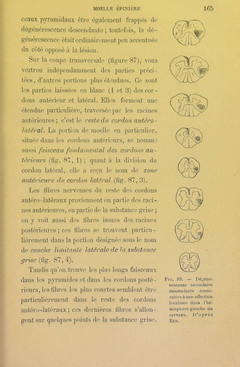 ceaux pyramidaux être également frappés de dégénérescence descendante ; toutefois, la dé- générescence était ordinairement peu accentuée du côté opposé à la lésion. Sur la coupe transversale (figure 87), vous veztrou indépendamment des parties préci- tées, d’autres portions plus étendues. Ce sont les parties laissées en blanc (1 et 3) des cor- dons antérieur et latéral. Elles forment une étendue particulière, traversée par les racines antérieures; c’est le reste du cordon antéro- latéral. La portion de moelle en particulier, située dans les cordons antérieurs, se nomme aussi faisceau fondamental des cordons an- térieurs (fig. 87, 1) ; quant à la division du cordon latéral, elle a reçu le nom de zone antérieure du cordon latéral (fig. 87, 3). Les fibres nerveuses du reste des cordons antéro-latéraux proviennent en partie des raci- nes antérieures, en partie de la substance grise ; on y voit aussi des fibres issues des racines postérieures ; ces libres se trouvent particu- lièrement dans la portion désignée sous le nom de couche limitante latérale de la substance grise (fig. 87, 4). Tandis qu’on trouve 1rs plus longs faisceaux dans les pyramides et dans les cordons posté- rieurs, les fibres les plus courtes semblent être particulièrement dans le reste des cordons antéro-latéraux ; ces dernières fibres s’allon- gent sur quelques points de la substance grise. Fig. S9. — Dégéné- rescence secondaire descendante consé- cutive à une affection localisée dans l'hé- mispliére gauche du cerveau. D’après Erb.