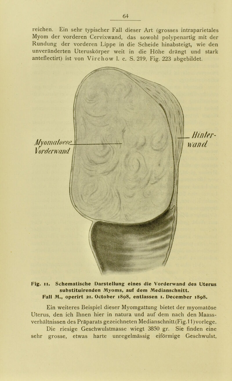 reichen. Ein sehr typischer Fall dieser Art (grosses intraparietales Myom der vorderen Cervixwand, das sowohl polypenartig mit der Rundung der vorderen Lippe in die Scheide hinabsteigt, wie den unveränderten Uteruskörper weit in die Höhe drängt und stark anteflectirt) ist von Virchow 1. c. S. 219, Fig. 223 abgebildet. Myomatoi's Vorclenvancl Hinter- wand Fig. II. Schematische Darstellung eines die Vorderwand des Uterus substituirenden Myoms, auf dem Medianschnitt. Fall M., operirt 21. October 1898, entlassen i. December 1898. Ein weiteres Beispiel dieser Myomgattung bietet der myomatöse Uterus, den ich Ihnen hier in natura und auf dem nach den Maass- verhältnissen des Präparats gezeichneten Medianschnitt(Fig.11)vorlege. Die riesige Geschwulstmasse wiegt 3850 gr. Sie finden eine sehr grosse, etwas harte unregelmässig eiförmige Geschwulst,