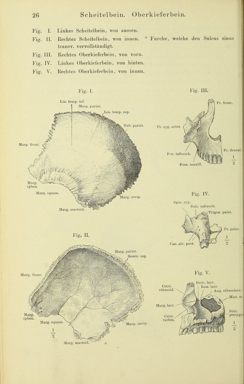 Fig. L Linkes Scheitelbein, von aussen. Fig. IL Rechtes Scheitelbein, von innen. * Furche, welche den Sulcus sinus transv. vervollständigt. Fig. IIL Rechtes Oberkieferbein, von vorn. Fig. IV. Linkes Oberkieferbein, von hinten. Fig. V. Rechtes Oberkieferbein, von innen. Fig. 1. Fig. IIL Lin. temp. inf. Marg. pariet. Marg. front Marg. sphen Marg. squani Aldis, (iccip. Marg. mastoid. Marg. pariet. Semis. sag. Marg. front Marg. sphen Marg. squam Marg. mastoid. ' t;!^;}-. Marg. occip. Pr. zyg. orbit. For. infraorb Foss. maxiU Fig. lY. Spin. zyg. Sulc. infraorb. y-Trigon. palat. Can. alv. post Pr. palat. Y