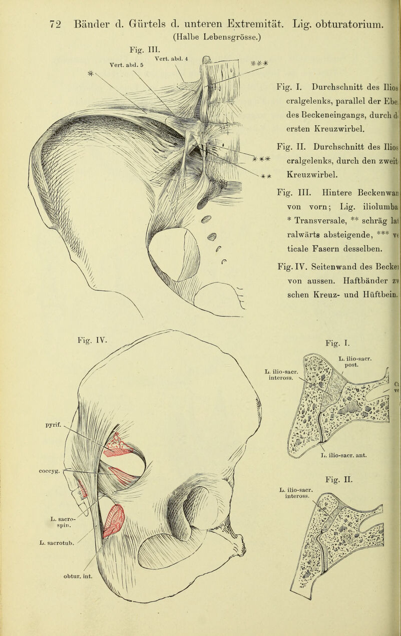 2 Bänder cl. Gürtels d. unteren Extremität. Lig. obturatorium. (Halbe Lebensgrösse.) Fig. III. Vert. abd. 4 Vert. abd. 5 Fig. I. Durchschnitt des Ilios cralgelenks, parallel der Ebe; des Becken eingangs, durch di ersten Kreuzwirbel. Fig. II. Durchschnitt des Ilios ^* cralgelenks, durch den zweit ^if, Kreuzwirbel. Fig. III. Hintere Beckenwar von vorn; Lig. iliolumba * Transversale, ** schräg lai ralwärts absteigende, *** ve ticale Fasern desselben. Fig. IV. Seitenwand des Beckeii von aussen. Haftbänder zy\ sehen Kreuz- und Hüftbein. Fig. I. Ii. ilio-sacr. L. ilio-sacr, inteross.