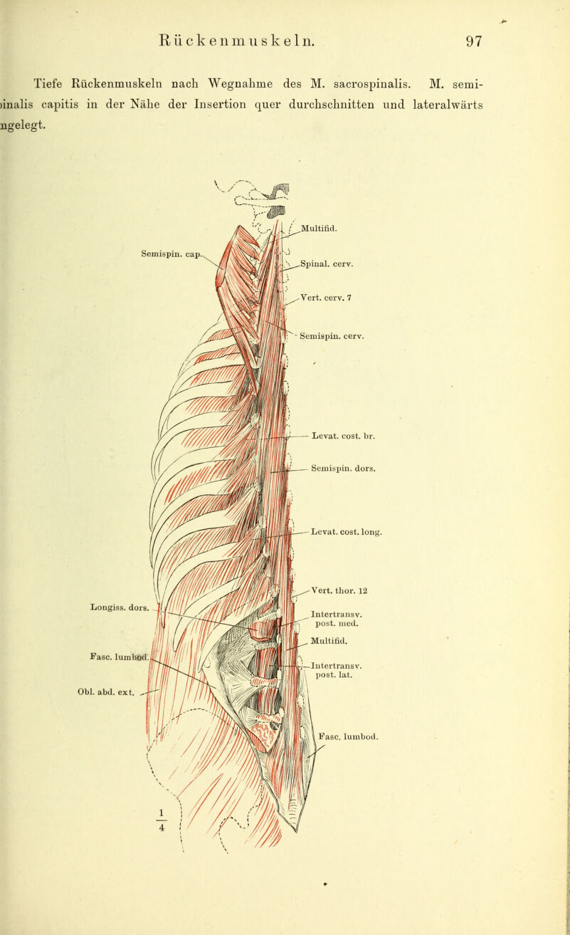 Tiefe Rückenmuskeln nach Wegnahme des M. sacrospinalis. M. semi- )inalis capitis in der Nähe der Insertion quer durchschnitten und lateralwärts ngelegt.