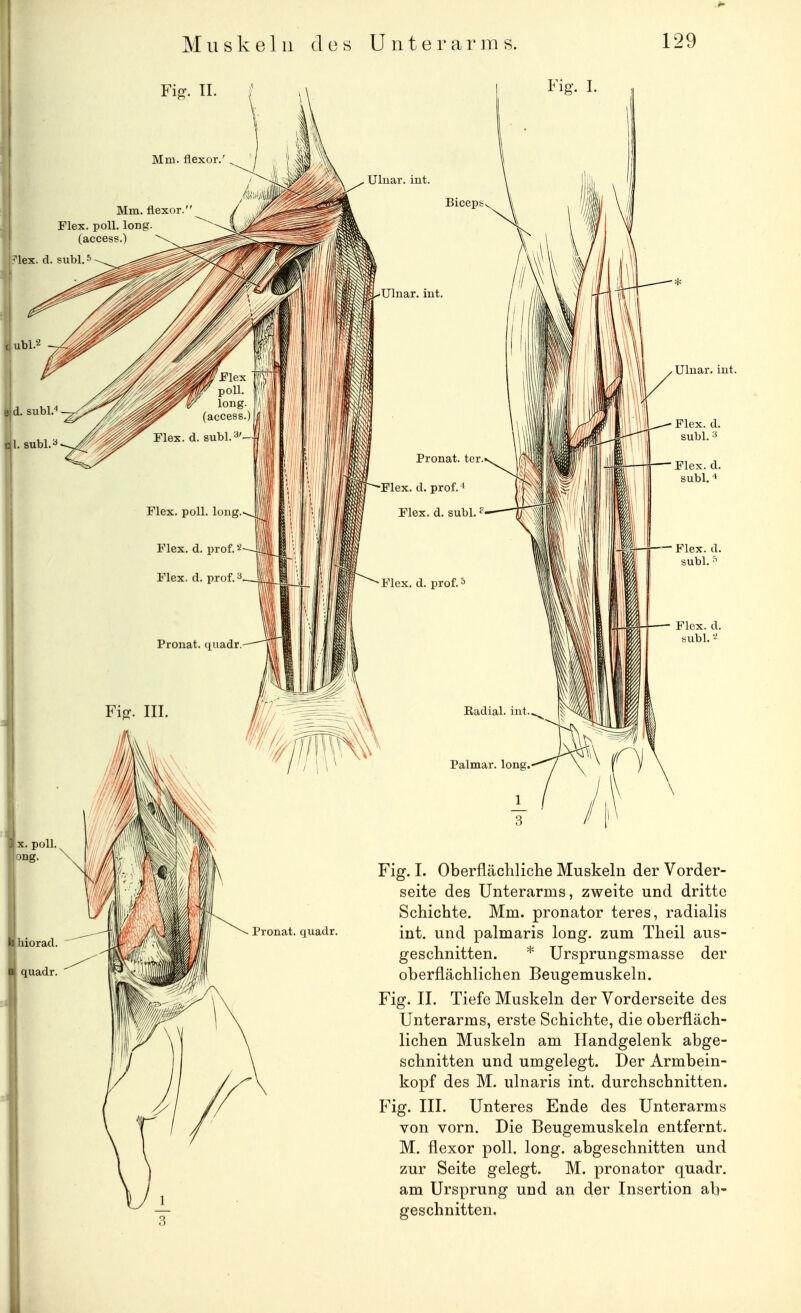 FijT. Tl. ; . \ I l^^ig- I Flex. poll. long (accea?.) Ulnar, int. Bicept Ulnar, int. Ulnar, int. Pronat. ter. Flex. d. prof.' Elex. d. subl. ^ Flex. d. prof. Flex. d. subl. Radial, int. Palmar, long Fig. I. Oberflächliche Muskeln der Vorder- seite des Unterarms, zweite und dritte Schichte. Mm. pronator teres, radialis int. und palmaris long, zum Theil aus- geschnitten. * Ursprungsmasse der oberflächlichen Beugemuskeln. Fig. II. Tiefe Muskeln der Vorderseite des Unterarms, erste Schichte, die oberfläch- lichen Muskeln am Handgelenk abge- schnitten und umgelegt. Der Armbein- kopf des M. ulnaris int. durchschnitten. Fig. III. Unteres Ende des Unterarms von vorn. Die Beugemuskeln entfernt. M. flexor poll. long, abgeschnitten und zur Seite gelegt. M. pronator quadr. am Ursprung und an der Insertion ab- geschnitten.