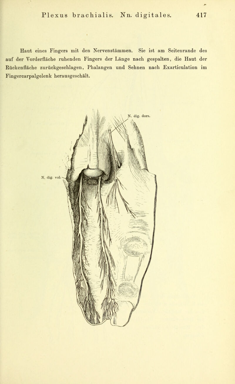 Haut eines Fingers mit den Nerven stammen. Sie ist am Seitenrande des auf der Yorderfläche ruhenden Fingers der Länge nach gespalten, die Haut der Rückenfläche zurückgeschlagen, Phalangen und Sehnen nach Exarticulation im Fingercarpalgelenk herausgeschält.