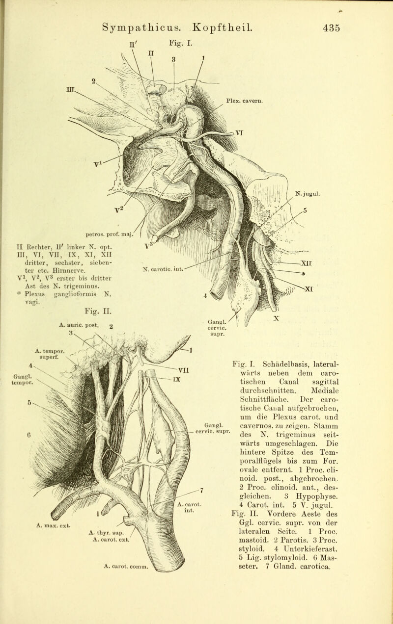 Fig. i. Plex. cavern. petros II Rechter, Ii' linker N. o III, VI, VII, IX, XI, XII dritter, sechster, sieben- ter etc. Hirn nerve. Vi, V2, V3 erster bis dritter Ast des N. trigeminus. * Plexus ganglioformis Vagi. Fi A. max. ext. Fig-. I. Schädelbasis, lateral- wärts neben dem caro- tischen Canal sagittal durchschnitten. Mediale SchnittHäche. Der caro- tische Canal aufgebrocheu, um die Plexus carot. und cavernos. zu zeigen. Stamm des N. trigeminus seit- wärts umgeschlagen. Die hintere Spitze des Tem- poralflügels bis zum For. ovale entfernt. 1 Proc. cli- noid. post., abgebrochen, 2 Proc. clinoid. ant., des- gleichen. 3 Hypophyse. 4 Carot. int. 5 V. jugul, Fig. II. Vordere Aeste des Ggl. cervic. supr. von der lateralen Seite. 1 Proc. mastoid. 2 Parotis. 3 Proc. styloid. 4 Unterkieferast. 5 Lig. stylomyloid. 6 Mas-