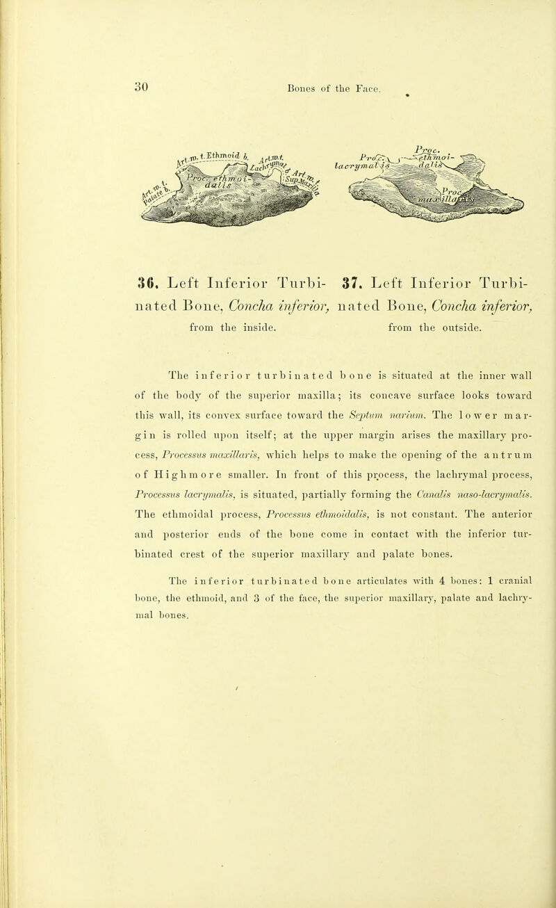 36. Left Inferior Turbi- nated Bone, Concha inferior, from the inside. 37. Left Inferior Turbi- nated Bone, Concha inferior, from the outside. The inferior turbinated bone is situated at the inner wall of the body of the superior maxilla; its concave surface looks toward this wall, its convex surface toward the Sej)tnm narium. The lower mar- gin is rolled upon itself; at the upper margin arises the maxillary pro- cess, Processus maxillaris, which helps to make the opening of the antrum of Highmore smaller. In front of this process, the lachrymal process, Processus lacrymalis, is situated, partially forming the Canalis naso-lacrymalis. The ethmoidal process, Processus etltmotdalis, is not constant. The anterior and posterior ends of the bone come in contact with the inferior tur- binated crest of the superior maxillary and palate bones. The inferior turbinated bone articulates with 4 bones: 1 cranial bone, the ethmoid, and 3 of the face, the superior maxillary, palate and lachry- mal bones.