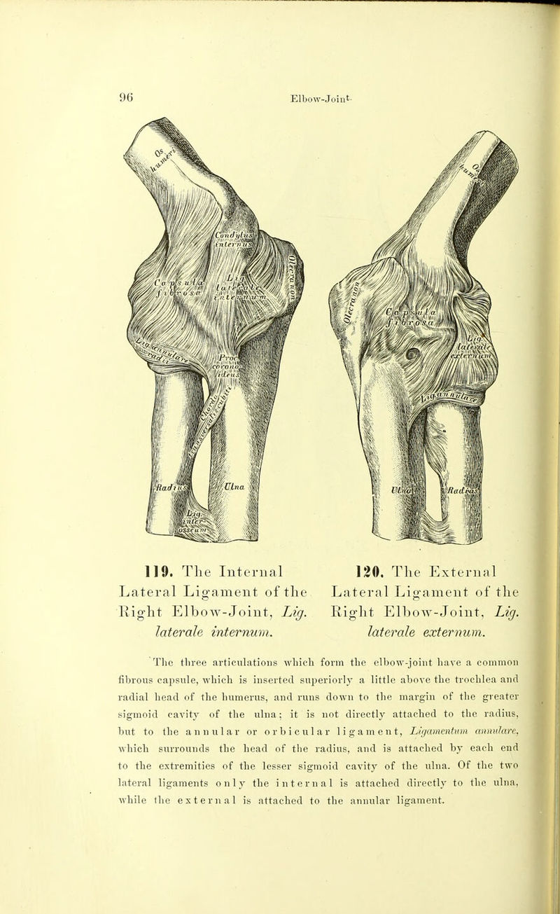 119. The Internal 120. The External Lateral Ligament of the Lateral Ligament of the Right Elbow-Joint, Lig. Right Elbow-Joint, Lig. laterals internum. laterals sxternum. The three articulations which form the elbow-joint have a common fibrous capsule, which is inserted superiorly a little above the trochlea and radial head of the humerus, and runs down to the margin of the greater sigmoid cavity of the ulna; it is not directly attached to the radius, but to the annular or orbicular ligament, Ligarmntum annulare, which surrounds the head of the radius, and is attached by each end to the extremities of the lesser sigmoid cavity of the ulna. Of the two lateral ligaments only the internal is attached directly to the ulna, while the external is attached to the annular ligament.