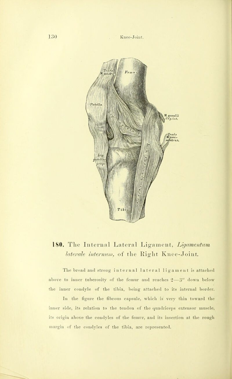 180, The Internal Lateral Ligament, Ligamentum laterale internum, of the Right Knee-Joint. The broad and strong internal lateral ligament is attached above to inner tuberosity of the femur and reaches 2 — 3 down below the inner condyle of the tibia, being attached to its internal border. In the figure the fibrous capsule, which is very thin toward the inner side, its relation to the tendon of the quadriceps extensor muscle, its origin above the condyles of the femur, and its insertion at the rough margin of the condyles of the tibia, are represented.