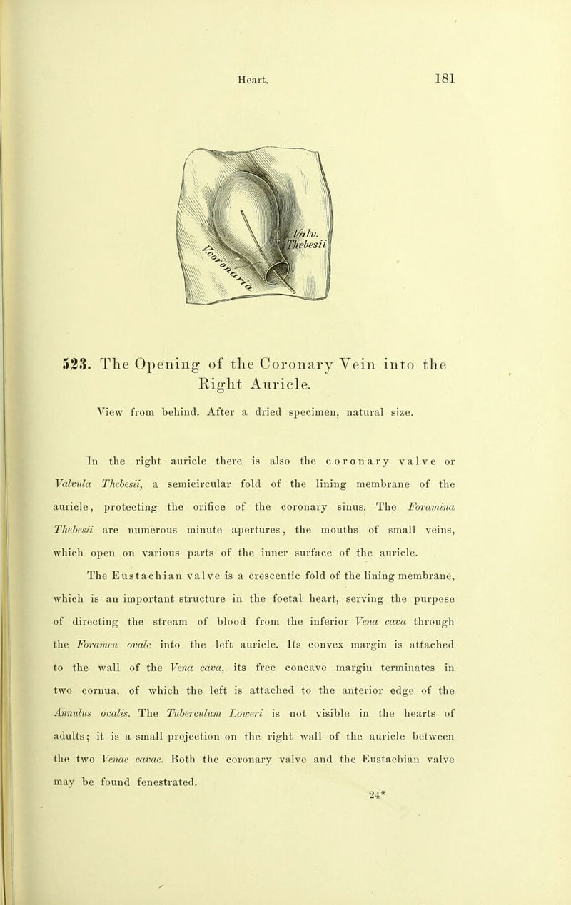 523. The Opening of the Coronary Vein into the Right Auricle. View from behind. After a dried specimen, natural size. In the right auricle there is also the coronary valve or Valvula Thebesii, a semicircular fold of the lining membrane of the auricle, protecting the orifice of the coronary sinus. The Foramina Thebcsii are numerous minute apertures, the mouths of small veins, which open on various parts of the inner surface of the auricle. The Eustachian valve is a crescentic fold of the lining membrane, which is an important structure in the foetal heart, serving the purpose of directing the stream of blood from the inferior Vena cava through the Foramen ovale into the left auricle. Its convex margin is attached to the wall of the Vena cava, its free concave margin terminates in two cornua, of which the left is attached to the anterior edge of the Anaulus ovalis. The Tuberculum Loweri is not visible in the hearts of adults; it is a small projection on the right wall of the auricle between the two Venae cavae. Both the coronary valve and the Eustachian valve may be found fenestrated. 24*