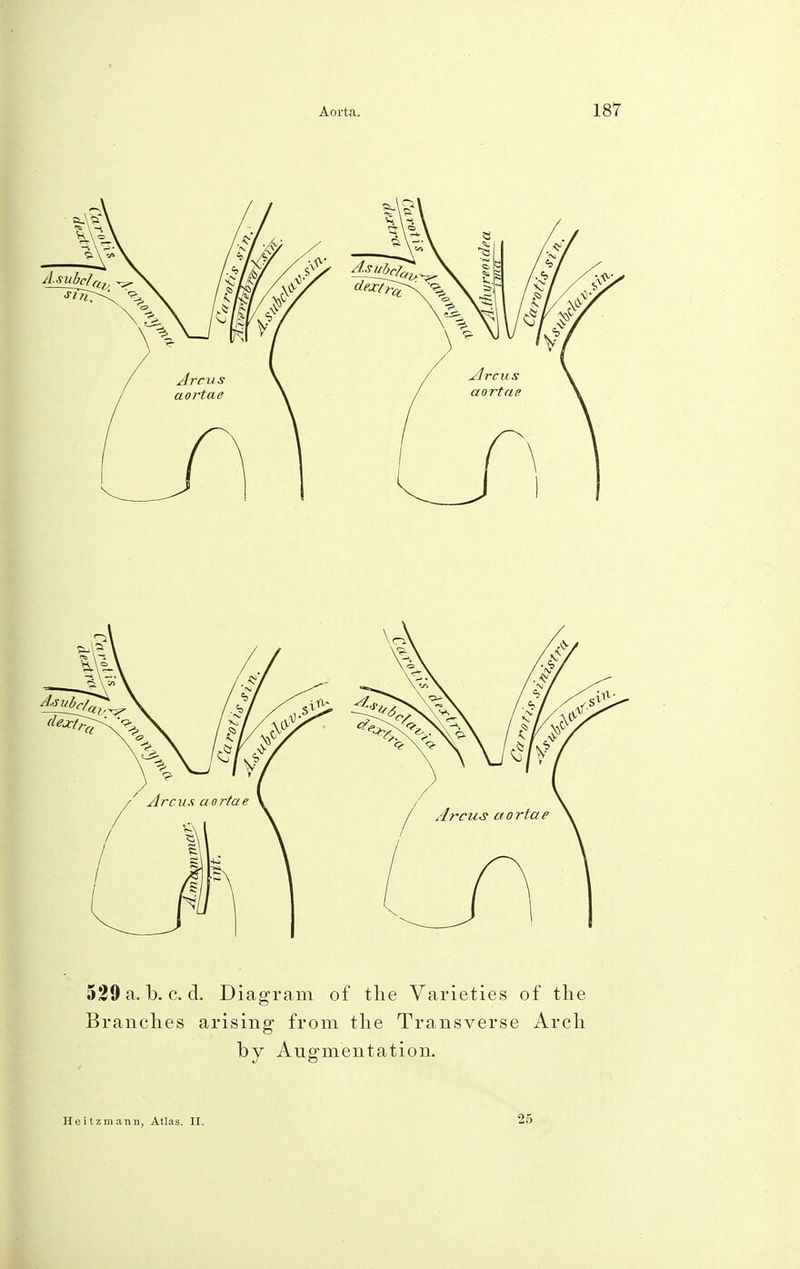 529 a. b. c. cl. Diagram of the Varieties of the Branches arising from the Transverse Arch by Augmentation. Heitzmann, Atlas. II. 25