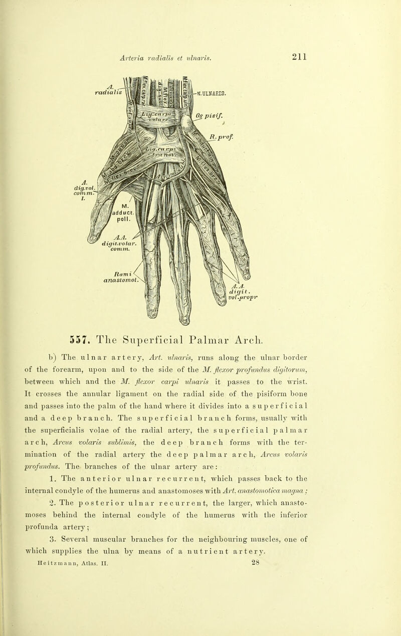 557. The Superficial Palmar Arch. b) The ulnar artery, Art. ulnaris, runs along the ulnar border of the forearm, upon and to the side of the M. flexor profundus digitorum, between which and the M. flexor carpi ulnaris it passes to the wrist. It crosses the annular ligament on the radial side of the pisiform bone and passes into the palm of the hand where it divides into a superficial and a deep branch. The superficial branch forms, usually with the superficialis volae of the radial artery, the superficial palmar arch, Arcus volaris sublimis, the deep branch forms with the ter- mination of the radial artery the deep palmar arch, Arcus volaris profundus. The branches of the ulnar artery are: 1. The anterior ulnar recurrent, which passes back to the internal condyle of the humerus and anastomoses with Art. anastomotica magna ; 2. The posterior ulnar recurrent, the larger, which anasto- moses behind the internal condyle of the humerus with the inferior profunda artery; 3. Several muscular branches for the neighbouring muscles, one of which supplies the ulna by means of a nutrient artery. Heitzmann, Atlas. II. 28