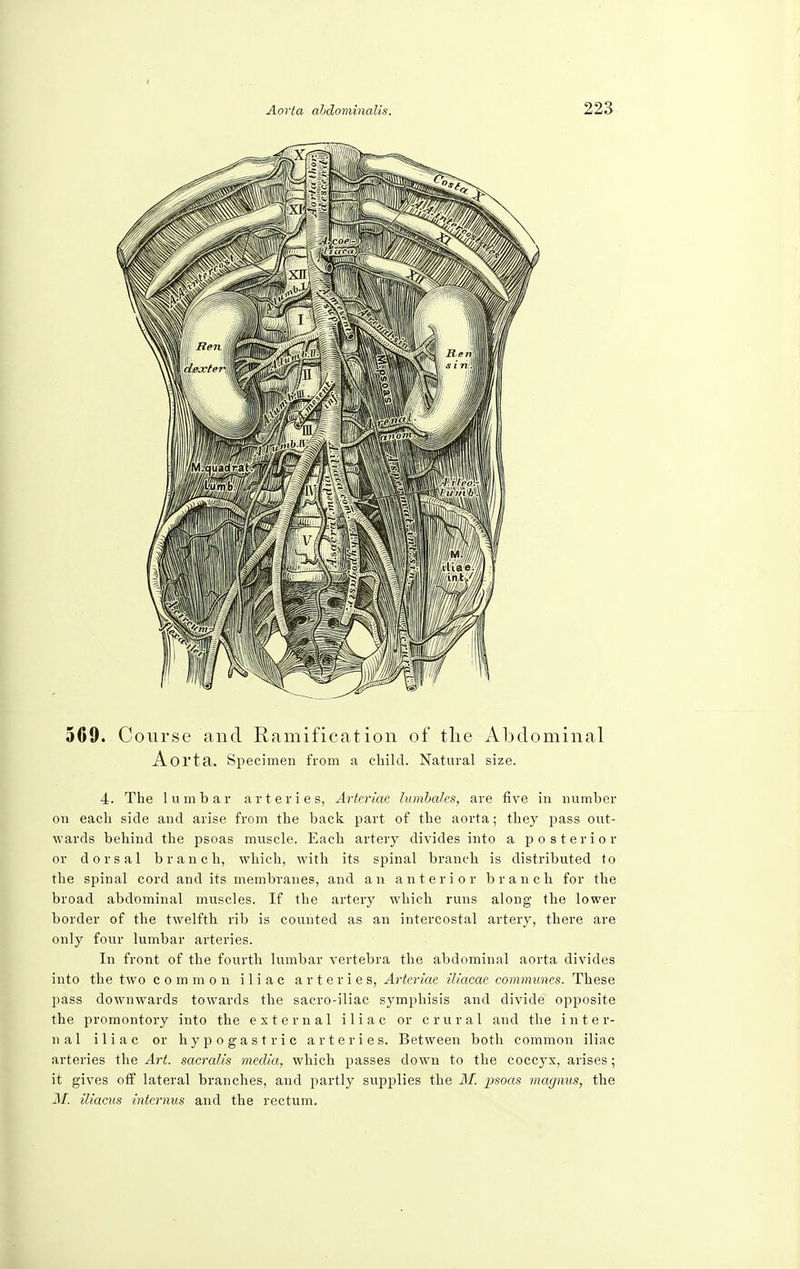 569. Course and Ramification of the Abdominal Aorta. Specimen from a child. Natural size. 4. The lumbar arteries, Arteriae lumbales, are five in number on each side and arise from the back part of the aorta; they pass out- wards behind the psoas muscle. Each artery divides into a posterior or dorsal branch, which, with its spinal branch is distributed to the spinal cord and its membranes, and an anterior branch for the broad abdominal muscles. If the artery which runs along the lower border of the twelfth rib is counted as an intercostal artery, there are only four lumbar arteries. In front of the fourth lumbar vertebra the abdominal aorta divides into the two common iliac arteries, Arteriae iliacae communes. These pass downwards towards the sacro-iliac symphisis and divide opposite the promontory into the external iliac or crural and the inter- nal iliac or hypogastric arteries. Between both common iliac arteries the Art. sacralis media, which passes down to the coccyx, arises; it gives off lateral branches, and partly supplies the M. psoas magnus, the M. iliacus interims and the rectum.