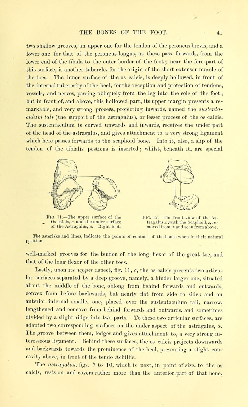 two shallow grooves, an upper one for the tendon of the peroneus brevis, and a lower one for that of the peroneus longus, as these pass forwards, from the lower end of the fibula to the outer border of the foot; near the fore-part of this surface, is another tubercle, for the origin of the short extensor muscle of the toes. The inner surface of the os calcis, is deeply hollowed, in front of the internal tuberosity of the heel, for the reception and protection of tendons, vessels, and nerves, passing obliquely from the leg into tlie sole of the foot; but in front of, and above, this hollowed part, its upper margin presents a re- markable, and very strong process, projecting inwards, named the sustenta- culum tali (the support of the astragalus), or lesser process of the os calcis. The sustentaculum is curved upwards and inwards, receives the under part of the head of the astragalus, and gives attachment to a very strong ligament which here passes forwards to the scaphoid bone. Into it, also, a slip of the tendon of the tibialis posticus is inserted ; whilst, beneatli it, are special Fig. 11.—The upper surface of the FiG. 12.—The front view of the As- ^ Os calcis, and the under surface tragalus,«,withthe Scaphoid, .v, re- ef the Astragalus, «. Eight foot. moved from it and seen from above. The asterisks and lines, indicate the points of contact of the bones when in their natural position. well-marked grooves for the tendon of the long flexor of the great toe, and that of the long flexor of the other toes. Lastly, upon its upper aspect, fig. 11, o, the os calcis presents two articu- lar surfaces separated by a deep groove, namely, a hinder larger one, situated about the middle of tlie bone, oblong from behind forwards and outwards, convex from before backwards, but nearly flat from side to side ; and an anterior internal smaller one, placed over the sustentaculum tali, narrow, lengthened and concave from behind forwards and outwards, and sometimes divided by a slight ridge into two parts. To these two articular surfaces, are adapted two corresponding surfaces on the under aspect of the astragalus, a. The groove between them, lodges and gives attachment to, a very strong in- terosseous ligament. Behind these surfaces, the os calcis projects downwards and backwards towards the prominence of the heel, presenting a slight con- cavity above, in front of the ten do Achillis. The astragalus, figs. 7 to 10, which is next, in point of size, to the os calcis, rests on and covers rather more than the anterior part of that bone,