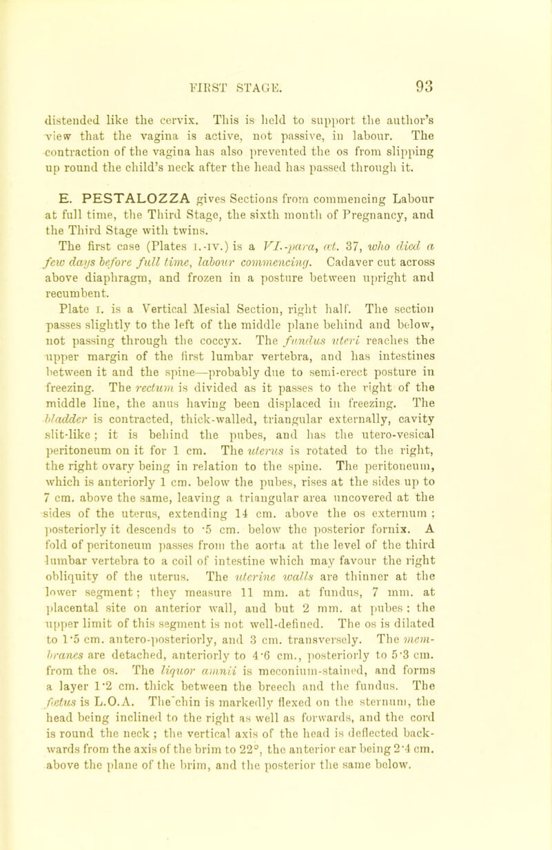 distended like tlie cervix. This is held to support the author’s view that the vagina is active, not passive, in labour. The contraction of the vagina has also prevented the os from slipping up round the child’s neck after the head has passed through it. E. PESTALOZZA gives Sections from commencing Labour at full time, the Third Stage, the sixth month of Pregnancy, and the Third Stage with twins. The first case (Plates i.-iv.)is a VI--para, ret. 37, who died a few days before full time, labour commencing. Cadaver cut across above diaphragm, and frozen in a posture between upright and recumbent. Plate i. is a Vertical Mesial Section, right half. The section passes slightly to the left of the middle plane behind and below, not passing through the coccyx. The fundus uteri reaches the upper margin of the first lumbar vertebra, and has intestines between it and the spine—probably due to semi-erect posture in freezing. The rectum is divided as it passes to the right of the middle line, the anus having been displaced in freezing. The ldodder is contracted, thick-walled, triangular externally, cavity slit-like; it is behind the pubes, and has the utero-vesical peritoneum on it for 1 cm. The uterus is rotated to the right, the right ovary being in relation to the spine. The peritoneum, which is anteriorly 1 cm. below the pubes, rises at the sides up to 7 cm. above the same, leaving a triangular area uncovered at the sides of the uterus, extending 14 cm. above the os externum ; posteriorly it descends to '5 cm. below the posterior fornix. A fold of peritoneum passes from the aorta at the level of the third lumbar vertebra to a coil of intestine which may favour the right obliquity of the uterus. The uterine walls are thinner at the lower segment; they measure 11 mm. at fundus, 7 mm. at placental site on anterior wall, and but 2 mm. at pubes : the upper limit of this segment is not well-defined. The os is dilated to 1*5 cm. antero-posteriorly, and 3 cm. transversely. The mem- branes are detached, anteriorly to 4-6 cm., posteriorly to 53 cm. from the os. The liquor amnii is meconium-stained, and forms a layer 1’2 cm. thick between the breech and the fundus. The f etus is L.O.A. The'chin is markedly flexed on the sternum, the head being inclined to the right as well as forwards, and the cord is round the neck ; the vertical axis of the head is deflected back- wards from the axis of the brim to 22°, the anterior ear being 2-4 cm. above the plane of the brim, and the posterior the same below.