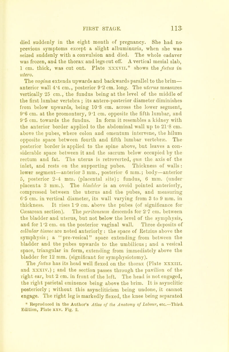 died suddenly in the eight month of pregnancy. She had no previous symptoms except a slight albuminuria, when she was seized suddenly with a convulsion and died. The whole cadaver was frozen, and the thorax and legs cut off. A vertical mesial slab, 1 cm. thick, was cut out. Plate xxxvii.* shows the foetus in utero. The vagina extends upwards and backwards parallel to the brim— anterior wall 4‘4 cm., posterior 9’2 cm. long. The uterus measures vertically 25 cm., the fundus being at the level of the middle of the first lumbar vertebra ; its antero-posterior diameter diminishes from below upwards, being 10'8 cm. across the lower segment, 9’6 cm. at the promontory, 9T cm. opposite the fifth lumbar, and 9 '5 cm. towards the fundus. In form it resembles a kidney with the anterior border applied to the abdominal wall up to 21’8 cm. above the pubes, where colon and omentum intervene, the hilum opposite space between fourth and fifth lumbar vertebrae. The posterior border is applied to the spine above, but leaves a con- siderable space between it and the sacrum below occupied by the rectum and fat. The uterus is retroverted, qua the axis of the inlet, and rests on the supporting pubes. Thickness of walls : lower segment—anterior 3 mm., posterior 6 mm.; body—anterior 5, posterior 2-4 mm. (placental site); fundus, 6 mm. (under placenta 3 mm.). The bladder is an ovoid pointed anteriorly, compressed between the uterus and the pubes, and measuring 6‘5 cm. in vertical diameter, its wall varying from 3 to 9 mm. in thickness. It rises 1‘9 cm. above the pubes (of significance for Gtesarean section). The 'peritoneum descends for 2 '7 cm. between the bladder and uterus, but not below the level of the symphysis, and for 1*2 cm. on the posterior vaginal wall. Three deposits of cellular tissue are noted anteriorly : the space of Retzius above the symphysis; a “pre-vesical” space extending from between the bladder and the pubes upwards to the umbilicus; and a vesical space, triangular in form, extending from immediately above the bladder for 12 mm. (significant for symphysiotomy). The foetus has its head well flexed on the thorax (Plate xxxm. and xxxiv.) ; and the section passes through the pavilion of the right ear, but 2 cm. in front of the left. The head is not engaged, the right parietal eminence being above the brim. It is asynclitic posteriorly ; without this asyncliticism being undone, it cannot engage. The right leg is markedly flexed, the knee being separated * Reproduced in the Author’s Atlas of the Anatomy of Labour, etc.—Third