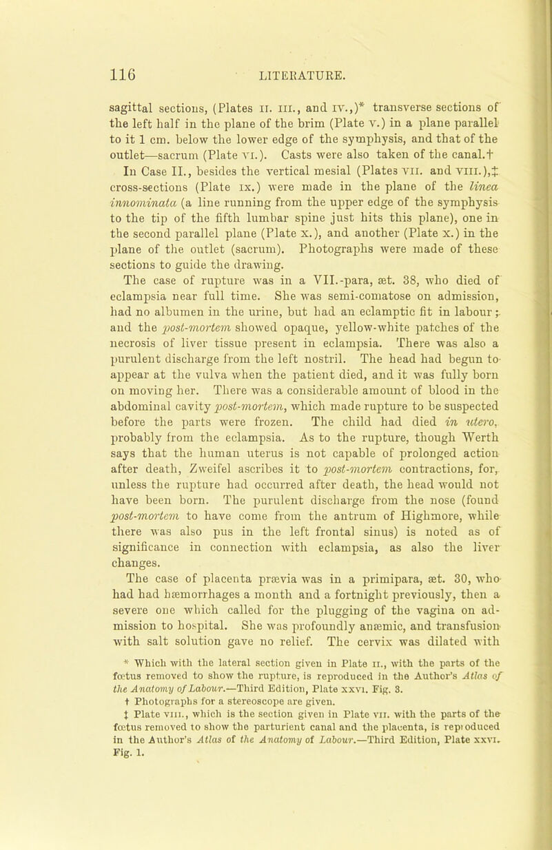 sagittal sections, (Plates II. ill., and IV.,)* transverse sections of the left half in the plane of the brim (Plate V.) in a plane parallel to it 1 cm. below the lower edge of the symphysis, and that of the outlet—sacrum (Plate vi.). Casts were also taken of the canal.f In Case II., besides the vertical mesial (Plate3 vn. and viii.),J cross-sections (Plate lx.) were made in the plane of the lined innominata (a line running from the upper edge of the symphysis to the tip of the fifth lumbar spine just hits this plane), one in the second parallel plane (Plate x.), and another (Plate x.) in the plane of the outlet (sacrum). Photographs were made of these sections to guide the drawing. The case of rupture was in a VII.-para, £et. 38, who died of eclampsia near full time. She w7as semi-comatose on admission, had no albumen in the urine, but had an eclamptic fit in labour and the post-mortem showed opaque, yellow-white patches of the necrosis of liver tissue present in eclampsia. There was also a purulent discharge from the left nostril. The head had begun to- appear at the vulva w'hen the patient died, and it was fully born on moving her. There was a considerable amount of blood in the abdominal cavity post-mortem, which made rupture to he suspected before the parts were frozen. The child had died in utero, probably from the eclampsia. As to the rupture, though Worth says that the human uterus is not capable of prolonged action after death, Zweifel ascribes it to post-mortem contractions, for, unless the rupture had occurred after death, the head would not have been born. The purulent discharge from the nose (found post-mortem to have come from the antrum of Highmore, while there was also pus in the left frontal sinus) is noted as of significance in connection with eclampsia, as also the liver changes. The case of placenta prtevia was in a primipara, set. 30, who had had haemorrhages a month and a fortnight previously, then a severe one which called for the plugging of the vagina on ad- mission to hospital. She was profoundly anaemic, and transfusion with salt solution gave no relief. The cervix was dilated with * 'Which with the lateral section given in Plate n., with the parts of the foetus removed to show the rupture, is reproduced in the Author’s Atlas of the Anatomy of Labour.—Third Edition, Plate xxvi. Fig. 3. t Photographs for a stereoscope are given. X Plate via., which is the section given in Plate vix. with the parts of the fcetus removed to show the parturient canal and the placenta, is rcpioduced in the Author’s Atlas of the Anatomy of Labour.—Third Edition, Plate xxvi. Fig. 1.