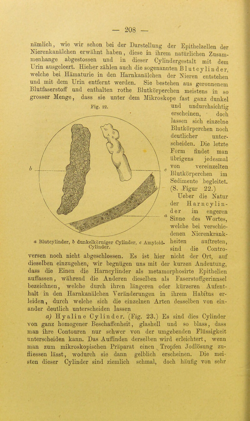 nämlicli, wie wir schon bei der Darstellung der Epitlielzellen der Nierenkanälchen erwähnt haben, diese in ihrem natürlichen Zusam- menhange abgestossen und in dieser Cylindergestalt mit dem Urin ausgeleert. Hieher zählen auch die sogenannten Blutcyliuder, welche^ bei Hämaturie in den Harnkanälchen der Nieren entstehen und mit dem Urin entfernt werden. Sie bestehen aus geronnenem Blutfaserstoflf und enthalten rothe Blutkörperchen meistens in so grosser Menge, dass sie unter dem Mikroskope fast ganz dunkel Mg. 22. und undurchsichtig erscheinen, doch lassen sich einzelne Blutkörperchen noch deutlicher unter- scheiden. Die letzte Form findet man übrigens jedesmal ^ von vereinzelten Blutkörperchen im Sedimente begleitet. (S. Figur 22.) Ueber die Natur der Harncylin- d e r im engeren Sinne des Wortes, welche bei verschie- denen Nierenkrank- a Blutcylinder, 6 dtuikelkörniger Cylinder, c Amyloid, heiten auftreten, Gj^^^ev. gjji^l ^Ije Contro- versen noch nicht abgeschlossen. Es ist hier nicht der Ort, auf dieselben einzugehen, wir begnügen uns mit der kurzen Andeutung, dass die Einen die Harncylinder als metamorphosirte Epithelien aufpassen, während die Anderen dieselben als FaserstofiFgerinnsel bezeichnen, welche durch ihren längeren oder kürzeren Aufent- halt in den Harnkanälchen Veränderungen in ihrem Habitus er- leiden, durch welche sich die einzelnen Arten desselben von ein- ander deutlich unterscheiden lassen a) Hyaline Cylinder, (Fig. 23.) Es sind dies Cylinder von ganz homogener Beschaffenheit, glashell und so blass, dass man ihre Contouren nur schwer von der umgebenden Flüssigkeit unterscheiden kann. Das Auffinden derselben wird erleichtert, wenn man zum mikroskopischen Präparat einen Tropfen Jodlösung zu- fliessen lässt, wodurch sie dann gelblich erscheinen. Die mei- sten dieser Cylinder sind ziemlich schmal, doch häufig von sehr