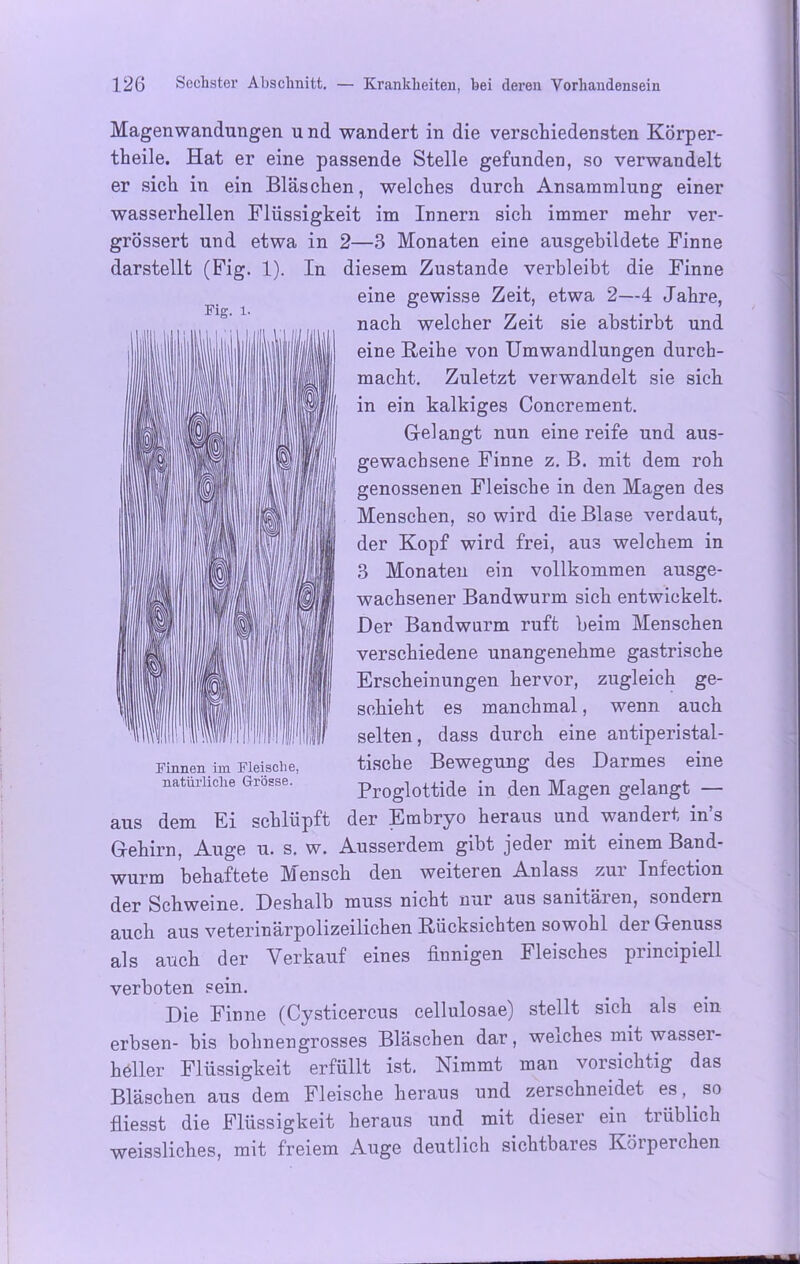 Magenwandungen u nd wandert in die verschiedensten Körper- theile. Hat er eine passende Stelle gefunden, so verwandelt er sich in ein Bläschen, welches durch Ansammlung einer wasserhellen Flüssigkeit im Innern sich immer mehr ver- grössert und etwa in 2—3 Monaten eine ausgebildete Finne darstellt (Fig. 1). In diesem Zustande verbleibt die Finne eine gewisse Zeit, etwa 2—4 Jahre, nach welcher Zeit sie abstirbt und eine Reihe von Umwandlungen durch- macht. Zuletzt verwandelt sie sich in ein kalkiges Concrement. Gelangt nun eine reife und aus- gewachsene Finne z. B. mit dem roh genossenen Fleische in den Magen des Menschen, so wird die Blase verdaut, der Kopf wird frei, aus welchem in 3 Monaten ein vollkommen ausge- wachsener Bandwurm sich entwickelt. Der Bandwarm ruft beim Menschen verschiedene unangenehme gastrische Erscheinungen hervor, zugleich ge- schieht es manchmal, wenn auch selten, dass durch eine antiperistal- tische Bewegung des Darmes eine Proglottide in den Magen gelangt — aus dem Ei schlüpft der Embryo heraus und wandert in’s Gehirn, Auge u. s. w. Ausserdem gibt jeder mit einem Band- wurm behaftete Mensch den weiteren Anlass zur Infection der Schweine. Deshalb muss nicht nur aus sanitären, sondern auch aus veterinärpolizeilichen Rücksichten sowohl dei Genuss als auch der Verkauf eines finnigen Fleisches principiell verboten sein. Die Finne (Cysticercus cellulosae) stellt sich als ein erbsen- bis bohnengrosses Bläschen dar, weiches mit wassei- heller Flüssigkeit erfüllt ist. Nimmt man vorsichtig das Bläschen aus dem Fleische heraus und zerschneidet es, so fliesst die Flüssigkeit heraus und mit dieser ein trüblich weissliches, mit freiem Auge deutlich sichtbares Körperchen Fig. 1. Finnen im Fleische, natürliche Grösse.