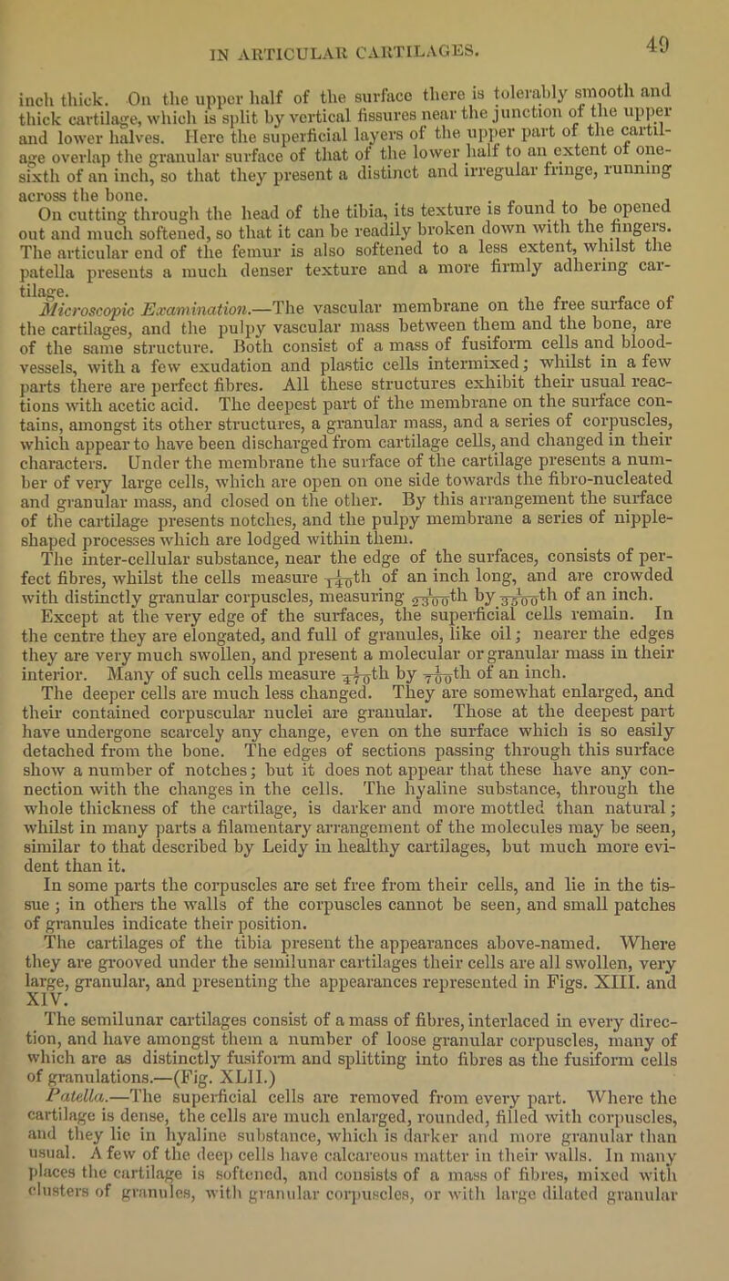 inch thick. On the upper half of the surface there is tolerably smooth anil thick cartilage, which is split by vertical fissures near the junction of the upper and lower halves. Here the superficial layers of the upper part of the cartu- a^e overlap the granular surface of that ot the lower half to an extent o one- sixth of an inch, so that they present a distinct and irregular fringe, running across the bone. . . On cutting through the head of the tibia, its texture is found to be opened out and much softened, so that it can be readily broken down with the fingeis. The articular end of the femur is also softened to a less extent, whilst the patella presents a much denser texture and a more firmly adhering cai- tilage. Microscopic Examination.—The vascular membrane on the free surface ot the cartilages, and the pulpy vascular mass between them and the bone, are of the same structure. Both consist of a mass of fusiform cells and blood- vessels, with a few exudation and plastic cells intermixed; whilst in a few parts there are perfect fibres. All these structures exhibit their usual reac- tions with acetic acid. The deepest part of the membrane on the surface con- tains, amongst its other structures, a granular mass, and a series of corpuscles, which appear to have been discharged from cartilage cells, and changed in their characters. Under the membrane the surface of the cartilage presents a num- ber of very large cells, which are open on one side towards the fibro-nucleated and granular mass, and closed on the other. By this arrangement the surface of the cartilage presents notches, and the pulpy membrane a series of nipple- shaped processes which are lodged within them. The inter-cellular substance, near the edge of the surfaces, consists of per- fect fibres, whilst the cells measure xioth of an inch long, and are crowded with distinctly granular corpuscles, measuring <2 0th by -g-J^th of an inch. Except at the very edge of the surfaces, the superficial cells remain. In the centre they are elongated, and full of granules, like oil; nearer the edges they are very much swollen, and present a molecular or granular mass in their interior. Many of such cells measure ^jyth by y^th of an inch. The deeper cells are much less changed. They are somewhat enlarged, and their contained corpuscular nuclei are granular. Those at the deepest part have undergone scarcely any change, even on the surface which is so easily detached from the bone. The edges of sections passing through this surface show a number of notches; but it does not appear that these have any con- nection with the changes in the cells. The hyaline substance, through the whole thickness of the cartilage, is darker and more mottled than natural; whilst in many parts a filamentary arrangement of the molecules may be seen, similar to that described by Leidy in healthy cartilages, but much more evi- dent than it. In some parts the corpuscles are set free from their cells, and lie in the tis- sue ; in others the walls of the corpuscles cannot be seen, and small patches of granules indicate their position. The cartilages of the tibia present the appearances above-named. Where they are grooved under the semilunar cartilages their cells are all swollen, very large, granular, and presenting the appearances represented in Figs. XIII. and XIV. The semilunar cartilages consist of amass of fibres,interlaced in every direc- tion, and have amongst them a number of loose granular corpuscles, many of which are as distinctly fusiform and splitting into fibres as the fusiform cells of granulations.—(Fig. XLII.) Patella.—The superficial cells are removed from every part. Where the cartilage is dense, the cells are much enlarged, rounded, filled with corpuscles, and they lie in hyaline substance, which is darker and more granular than usual. A few of the deep cells have calcareous matter in their walls. In many places the cartilage is softened, and consists of a mass of fibres, mixed with clusters of granules, with granular corpuscles, or with large dilated granular