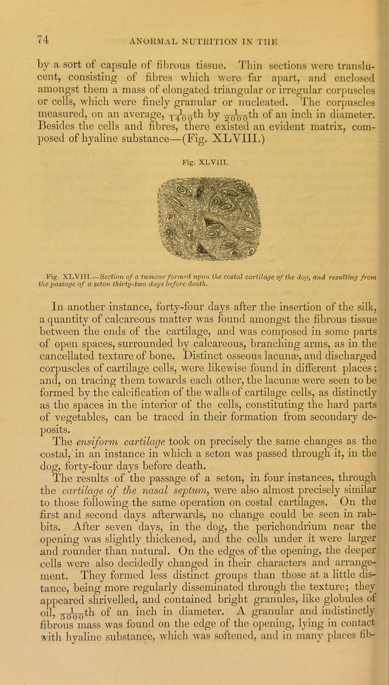 by a sort of’ capsule of fibrous tissue. Thin sections were translu- cent, consisting of fibres which were far apart, and enclosed amongst them a mass of elongated triangular or irregular corpuscles or cells, which were finely granular or nucleated. The corpuscles measured, on an average, y^yth by ^oVoth of an inch in diameter. Besides the cells and fibres, there existed an evident matrix, com- posed of hyaline substance—(Fig. XLVIII.) Fig. XLVIH. Fig. XLVIll.—Section of a tumour formed upon the costal cartilage of the dog, and resulting from the passage of a seton thirty-two days before death. In another instance, forty-four days after the insertion of the silk, a quantity of calcareous matter was found amongst the fibrous tissue between the ends of the cartilage, and was composed in some parts of open spaces, surrounded by calcareous, branching arms, as in the cancellated texture of bone. Distinct osseous lacunas, and discharged corpuscles of cartilage cells, were likewise found in different places; and, on tracing them towards each other, the lacunas were seen to be formed by the calcification of the walls of cartilage cells, as distinctly as the spaces in the interior of the cells, constituting the hard parts of vegetables, can be traced in their formation from secondary de- posits. The ansiform cartilage took on precisely the same changes as the costal, in an instance in which a seton was passed through it, in the dog, forty-four days before death. The results of the passage of a seton, in four instances, through the cartilage of the nasal septum, were also almost precisely similar to those following the same operation on costal cartilages. On the first and second days afterwards, no change could be seen in rab- bits. After seven days, in the dog, the perichondrium near the opening was slightly thickened, and the cells under it were larger and rounder than natural. On the edges of the opening, the deeper cells were also decidedly changed in their characters and arrange- ment. They formed less distinct groups than those at a little dis- tance, being more regularly disseminated through the texture; they appeared shrivelled, and contained bright granules, like globules of oil, ^jVfjth of an inch in diameter. A granular and indistinctly fibrous mass was found on the edge of the opening, lying in contact with hyaline substance, which was softened, and in many places fib-