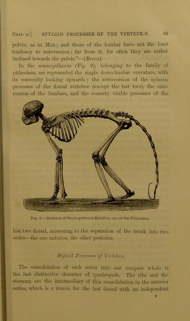 pelvis, as in Man; and tliose of the lmnbar have not the least tendency to anteversion ; far from it, for often they are rather inclined towards the pelvis.”—(Broca). In the semnopithecus (Fig. 9), belonging to the family of pithecians, are represented the single dorso-lnmhar curvature, with its convexity looking upwards ; the retroversion of the spinous processes of the dorsal vertebras (except the last two), the ante- version of the lumbars, and the scarcely visible processes of the Fig. 9.—Skeleton of Semnopithecus Entellus, one of the Pithecians. last two dorsal, answering to the separation of the trunk into two series—the one anterior, the other posterior. Styloid Processes of Vertebrae. The consolidation of each series into one compact whole is the last distinctive character of quadrupeds. The ribs and the sternum are the intermediary of this consolidation in the anterior series, which is a reason for the last dorsal witli an independent F