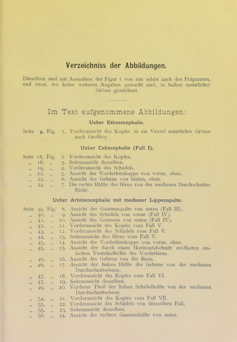 Verzeichniss der Abbildungen. Dieselben sind mit Ausnahme der Figur i von mir selsbt nach den Präparaten, und zwar, wo keine weiteren Angaben gemacht sind, in halber natürlicher Grösse gezeichnet. Im Text aufgenommene Abbildungen: Seite 9, Fig. 1. Seite 18, Fig. 2. 18, „ 3- >> 19, „ 4- ) J 99 5- 99 6. >> 21 *JT’ 55 7- Ueber Seite 39, Fig. 8. >> 40, „ 9. V 4L „ 10. 42, „ 11. 43, „ 12. 44, „ 13. >> 45, ,, 14. >> 45, „ 15- 46, >> 16. >> 46, ,, 17- >> 47, „ 18. 47, „ 19. >> 49, ,, 20. >> 54, „ 21. >> 55, ,, 22. >> 55, ,, 23- >> 56, „ 24. Ueber Ethmocephalie. Vorderansicht des Kopfes in ein Viertel natürlicher Grösse nach Geoffroy. Ueber Cebocephalie (Fall I). Vorderansicht des Kopfes. Seitenansicht desselben. Vorderansicht des Schädels. Ansicht der Vorderhirnkappe von vorne, oben. Ansicht des Gehirns von hinten, oben. Die rechte Hälfte des Hirns von der medianen Durchschnitts- fläche. Arhinencephalie mit medianer Lippenspalte. Ansicht der Gaumenspalte von unten (Fall III). Ansicht des Schädels von vorne (Fall IV). Ansicht des Gaumens von unten (Fall IV). Vorderansicht des Kopfes vom Fall V. Vorderansicht des Schädels vom Fall V. Seitenansicht des Hirns vom Fall V. Ansicht der Vorderhirnkappe von vorne, oben. Ansicht der durch einen Horizontalschnitt eröffneten ein- fachen Ventrikelhöhle des Vorderhirns. Ansicht des Gehirns von der Basis. Ansicht der linken Hälfte des Gehirns von der medianen Durchschnittsebene. Vorderansicht des Kopfes vom Fall VI. Seitenansicht desselben. Vorderer Theil der linken Schädelhälfte von der medianen Durchschnittsebene. Vorderansicht des Kopfes vom Fall VII. Vorderansicht des Schädels von demselben Fall. Seitenansicht desselben. Ansicht der rechten Gaumenhälfte von unten.