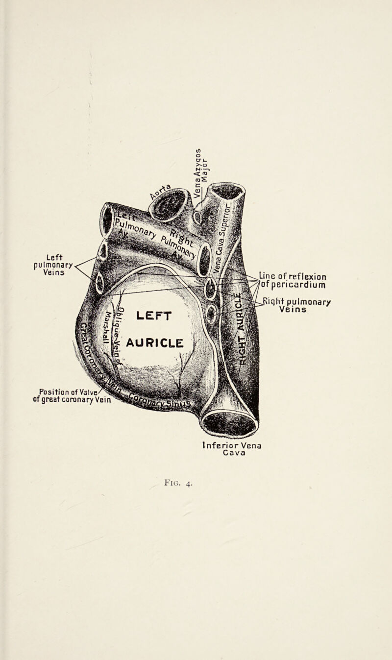 Left pulmonary Veins Position of Valve of great coronary Vein Line of reflexion of pericardium Riqht pulmonary Veins I nferior Vena Cava