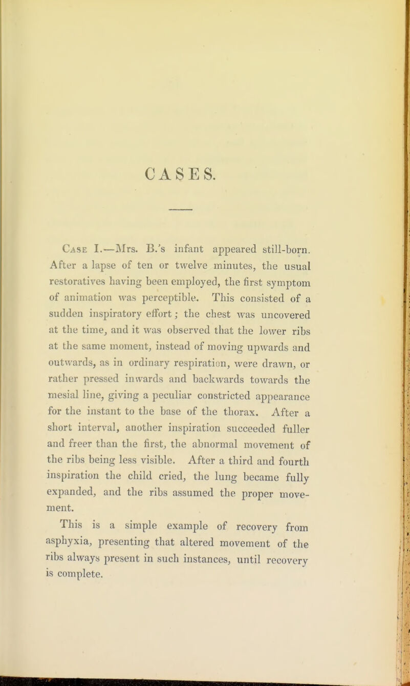 CASES. Ci^sE I.—Mrs. B.'s infant appeared still-born. After a lapse of ten or twelve minutes, the usual restoratives having been employed, the first symptom of animation was perceptible. This consisted of a sudden inspiratory effort; the chest was uncovered at the time, and it was observed that the lower ribs at the same moment, instead of moving upwards and outwards, as in ordinary respiration, were drawn, or rather pressed inwards and backwards towards the mesial line, giving a peculiar constricted appearance for the instant to the base of the thorax. After a short interval, another inspiration succeeded fuller and freer than the first, the abnormal movement of the ribs being less visible. After a third and fourth inspiration the child cried, the lung became fully expanded, and the ribs assumed the proper move- ment. This is a simple example of recovery from asphyxia, presenting that altered movement of the ribs always present in such instances, until recovery is complete.