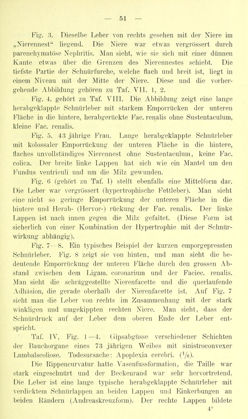 Fig. 3. Dieselbe Leber von i'echts gesehen mit der Niere im „Niei'ennest liegend. Die Niere wai- et\\'as vergrössert dui'ch parenchymatöse Nephritis. Man sieht, wie sie sich mit einer dünnen Kante etwas über die Grenzen des Niei'ennestes schiebt. Die tiefste Partie der Schnürfurche, welche flach und breit ist, liegt in einem Niveau mit der Mitte der Niere. Diese und die voi'her- gehende Abbildung gehören zu Taf. Vll. 1, 2. Fig. 4. gehört zu Taf. VIIT. Die Abbildung zeigt eine lange herabgeklappte Schnürleber mit starkem Empovrücken der unteren Fläche in die hintere, lierabgerückte Fac. renalis ohne Sustentaculum, kleine h'ac. renalis. Fig. 5. 43 jährige Frau. Lange herabgeklappte Schnürleber mit kolossaler Emporrückung der unteien Fläche in die hintere, flaches unvollständiges Nierennest ohne Sustentaculum, keine Fac. colica. Dei' breite linke Lappen hat sich wie ein Mantel um den Fundus ventriculi und um die Milz gewunden. Fig. 6 (gehört zu Taf. 1) stellt ebenfalls eine Mittel form dar. Die Ijcber war vergrössert (hypertrophische Fettlebei'). Man sieht eine nicht so geringe Emporrückung der unteren Fläche in die hintere und Herab- (Hervor-) rückung der Fac. renalis. Der linke Lappen ist nach innen gegen die Milz gefaltet. (Diese Form ist sicherlich von einer Kombination der Hypertrophie mit der Schnür- wirkung abhängig). Fig. 7- 8. Ein typisches Beispiel der kurzen emporgepressten Schnürleber. Fig. 8 zeigt sie von hinten, und man sieht die be- deutende Emporrückung der unteren Fläche durch den grossen Ab- stand zwischen dem Ligam. coronarium und der Faciec. renalis.. Man sieht die schräggestellte Nierenfacette und die querlaufende Adhäsion, die gerade oberhalb der Nierenfaeette ist. Auf Fig. 7 sieht man die Leber von i-echts im Zusammenhang mit der stark winkligen und umgekippten i-echten Niere. Man sieht, dass der Sehnüi'druek auf der Leber dem oberen Ende der Leber ent- spricht. Taf. TV, Fig. 1 —4. (xipsabgüsse verschiedener Schichten der 13auchorgane eines 73 jährigen Weibes mit sinistroconvexer Lumbalscoliose. Todesursache: Apoplexia cei'ebri. (Ye). Die Rippencurvatur hatte Vasenfussformation, die Taille war stai'k eingeschnüi't und der Beckenrand war sehr hervortretend. Die Leber ist eine lange typische herabgeklappte Schnürleber mit verdicktem Schnürlappen an beiden Lappen und Einkei'bungen an beiden Rändern (Andreaskreuzform). Der rechte Lappen bildete