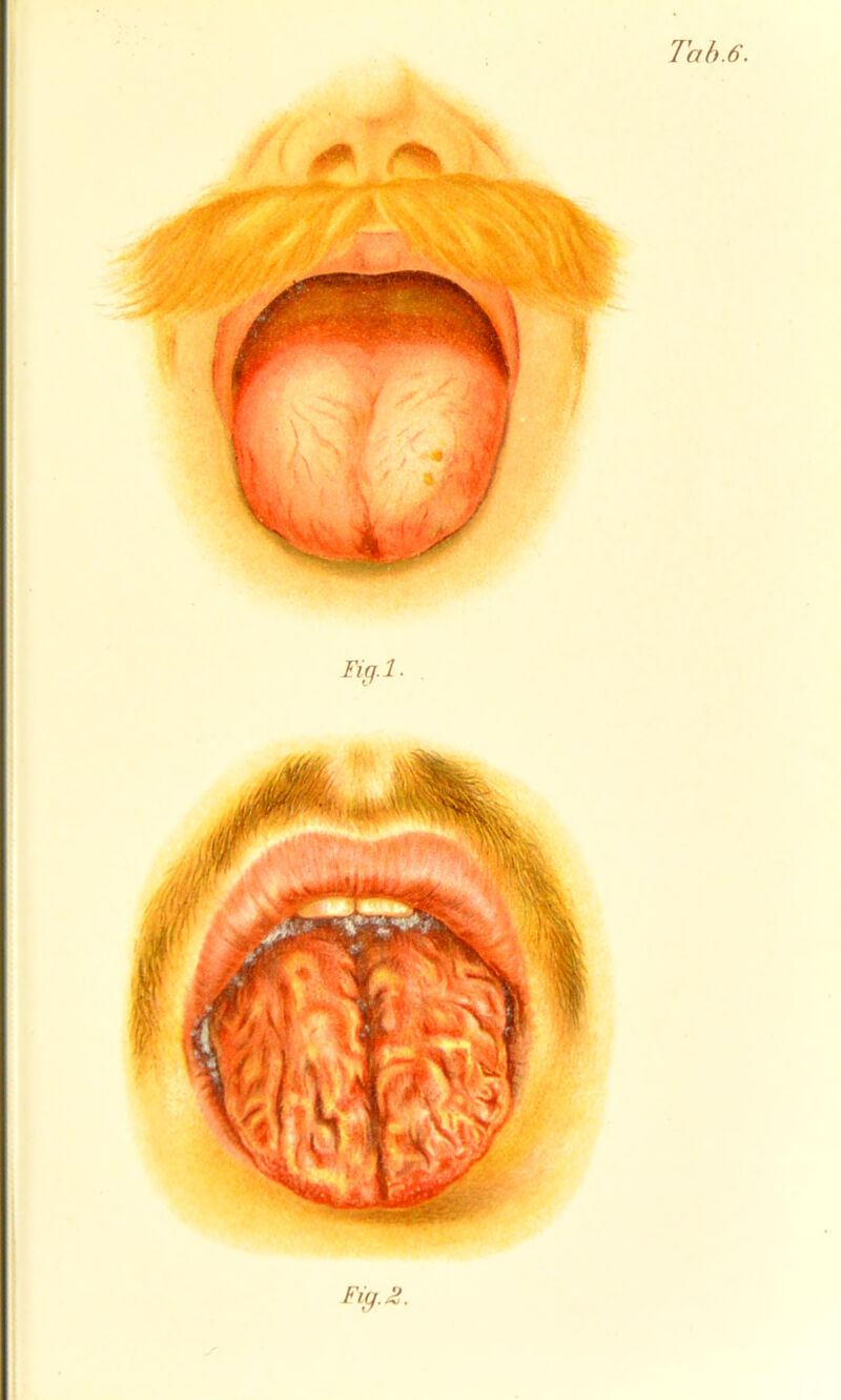 l'ab.6. Figl-