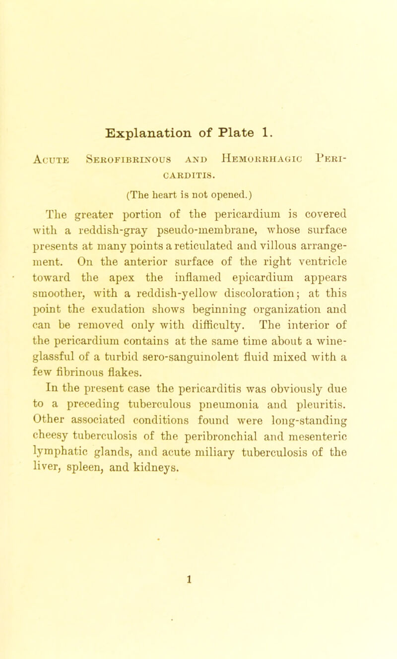 Acute Serofibrinous and Hemorrhagic Peri- carditis. (The heart is not opened.) The greater portion of the pericardium is covered with a reddish-gray pseudo-membrane, whose surface presents at many points a reticulated and villous arrange- ment. On the anterior surface of the right ventricle toward the apex the inflamed epicardium appears smoother, with a reddish-yellow discoloration; at this point the exudation shows beginning organization and can be removed only with difficulty. The interior of the pericardium contains at the same time about a wine- glassful of a turbid sero-sangumolent fluid mixed with a few fibrinous flakes. In the present case the pericarditis was obviously due to a preceding tuberculous pneumonia and pleuritis. Other associated conditions found were long-standing cheesy tuberculosis of the peribronchial and mesenteric lymphatic glands, and acute miliary tuberculosis of the liver, spleen, and kidneys. 1