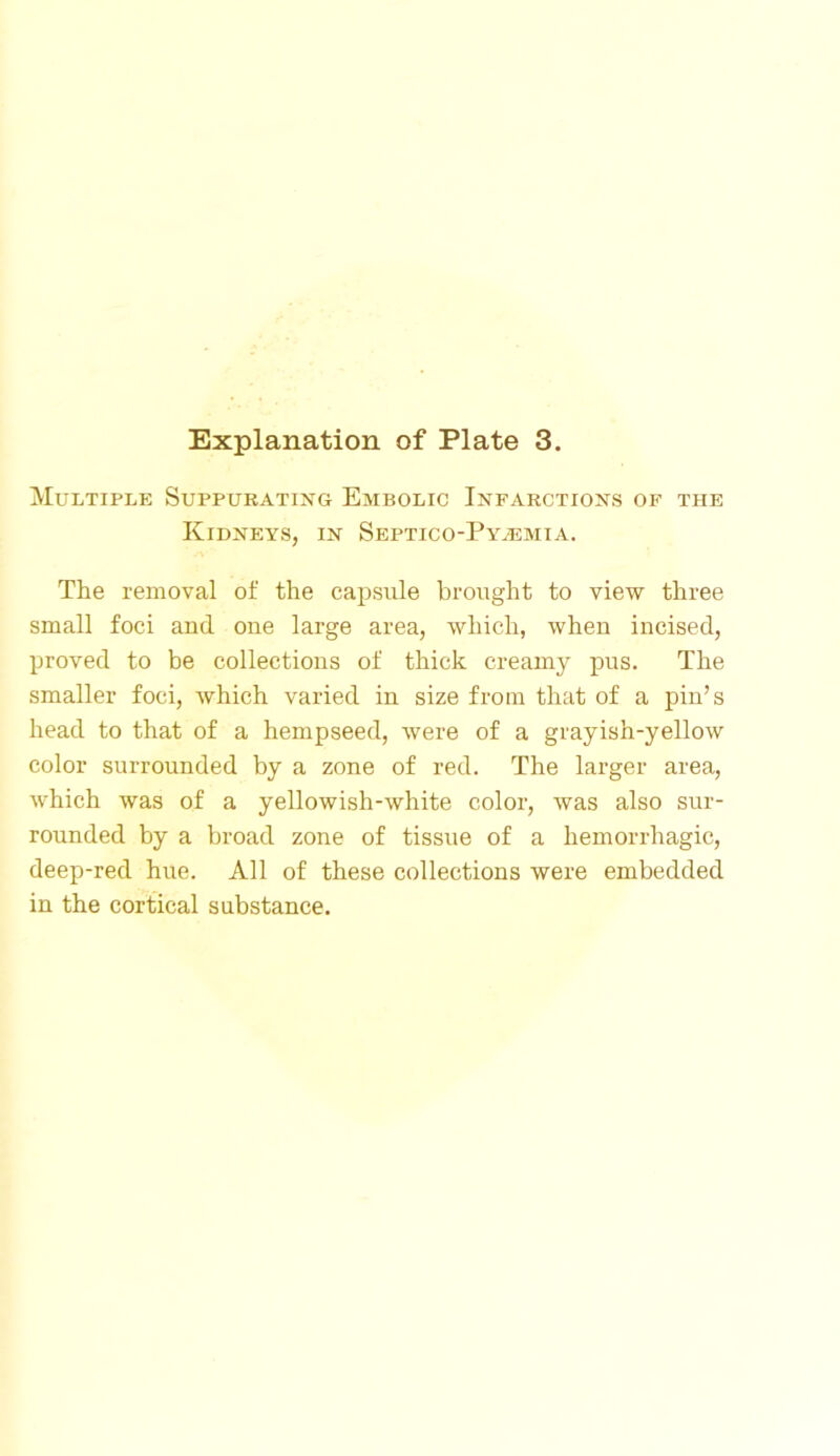Multiple Suppurating Embolic Infarctions of the Kidneys, in Septico-Py^emia. The removal of the capsule brought to view three small foci and one large area, which, when incised, proved to be collections of thick creamy pus. The smaller foci, which varied in size from that of a pin’s head to that of a hempseed, were of a grayish-yellow color surrounded by a zone of red. The larger area, which was of a yellowish-white color, was also sur- rounded by a broad zone of tissue of a hemorrhagic, deep-red hue. All of these collections were embedded in the cortical substance.