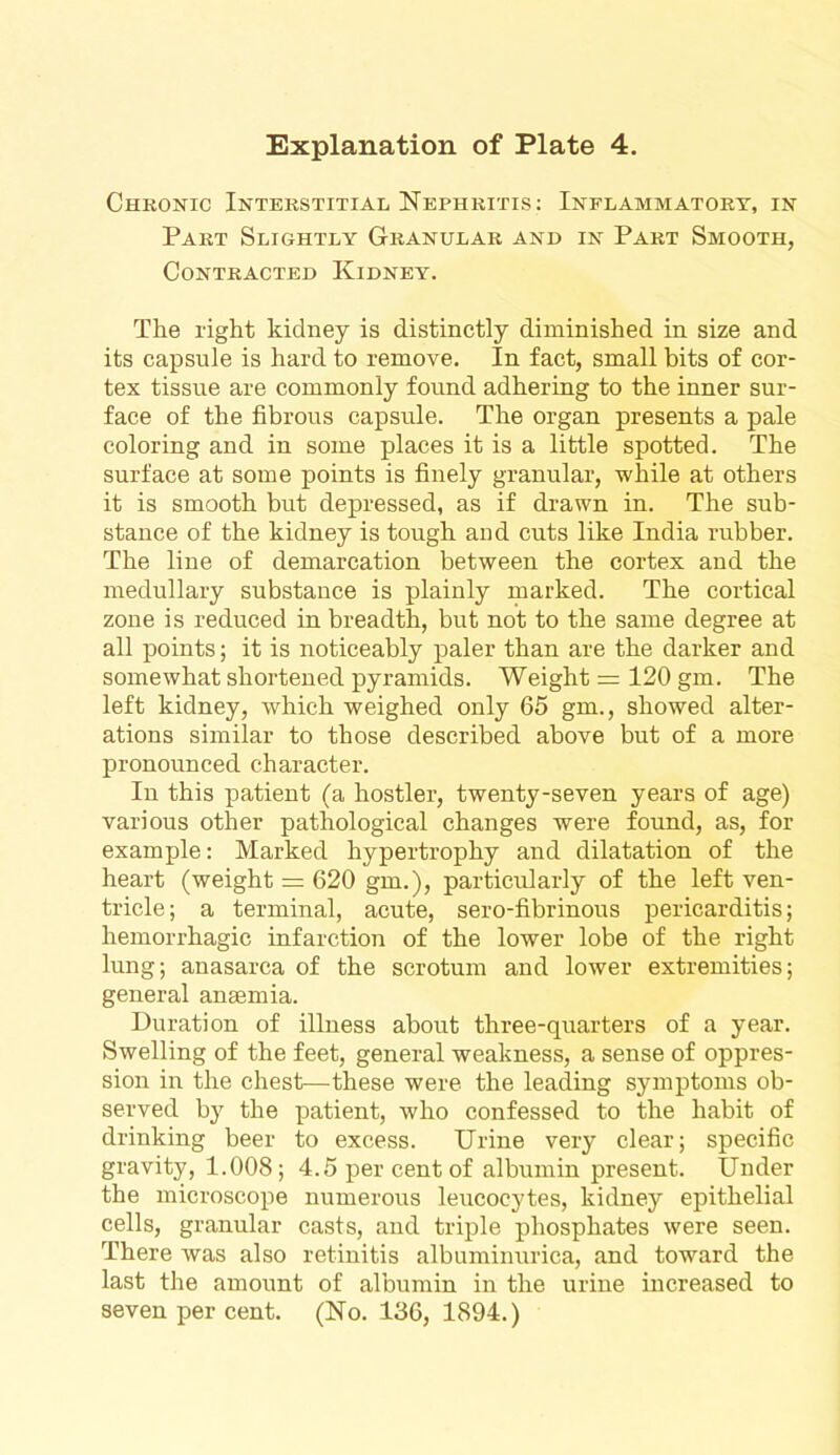 Chronic Interstitial Nephritis: Inflammatory, in Part Slightly Granular and in Part Smooth, Contracted Kidney. The right kidney is distinctly diminished in size and its capsule is hard to remove. In fact, small bits of cor- tex tissue are commonly found adhering to the inner sur- face of the fibrous capsule. The organ presents a pale coloring aud in some places it is a little spotted. The surface at some points is finely granular, while at others it is smooth but depressed, as if drawn in. The sub- stance of the kidney is tough and cuts like India rubber. The line of demarcation between the cortex and the medullary substance is plainly marked. The cortical zone is reduced in breadth, but not to the same degree at all points; it is noticeably paler than are the darker and somewhat shortened pyramids. Weight = 120 gm. The left kidney, which weighed only 65 gm., showed alter- ations similar to those described above but of a more pronounced character. In this patient (a hostler, twenty-seven years of age) various other pathological changes were found, as, for example: Marked hypertrophy and dilatation of the heart (weight = 620 gm.), particularly of the left ven- tricle; a terminal, acute, sero-fibrinous pericarditis; hemorrhagic infarction of the lower lobe of the right lung; anasarca of the scrotum and lower extremities; general anaemia. Duration of illness about three-quarters of a year. Swelling of the feet, general weakness, a sense of oppres- sion in the chest—these were the leading symptoms ob- served by the patient, who confessed to the habit of drinking beer to excess. Urine very clear; specific gravity, 1.008; 4.5 per cent of albumin present. Under the microscope numerous leucocytes, kidney epithelial cells, granular casts, and triple phosphates were seen. There was also retinitis albuminurica, and toward the last the amount of albumin in the urine increased to seven per cent. (No. 136, 1894.)