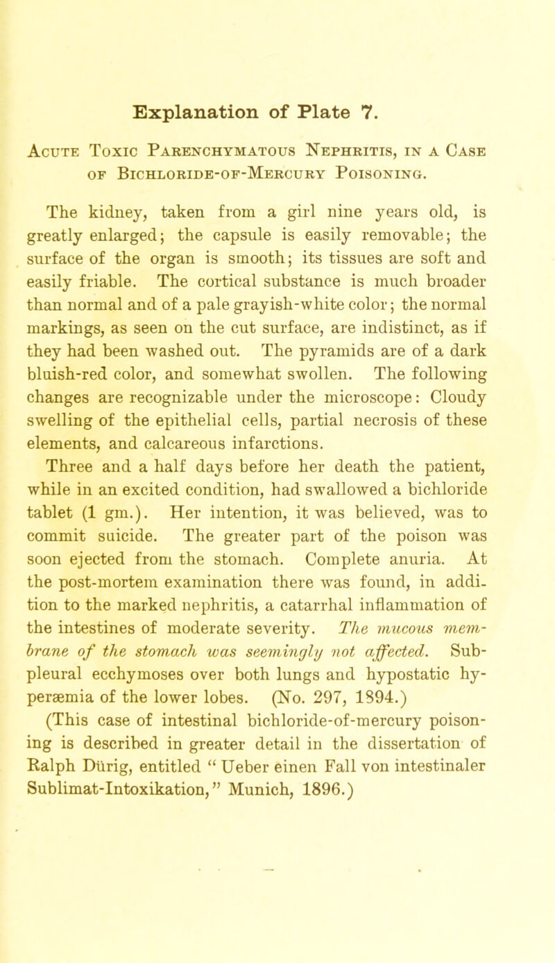 Acute Toxic Parenchymatous Nephritis, in a Case of Bichloride-of-Mercury Poisoning. The kidney, taken from a girl nine years old, is greatly enlarged; the capsule is easily removable; the surface of the organ is smooth; its tissues are soft and easily friable. The cortical substance is much broader than normal and of a pale grayish-white color; the normal markings, as seen on the cut surface, are indistinct, as if they had been washed out. The pyramids are of a dark bluish-red color, and somewhat swollen. The following changes are recognizable under the microscope: Cloudy swelling of the epithelial cells, partial necrosis of these elements, and calcareous infarctions. Three and a half days before her death the patient, while in an excited condition, had swallowed a bichloride tablet (1 gm.). Her intention, it was believed, was to commit suicide. The greater part of the poison was soon ejected from the stomach. Complete anuria. At the post-mortem examination there was found, in addi- tion to the marked nephritis, a catarrhal inflammation of the intestines of moderate severity. The mucous mem- brane of the stomach was seemingly not affected. Sub- pleural ecchymoses over both lungs and hypostatic hy- persemia of the lower lobes. (No. 297, 1894.) (This case of intestinal bichloride-of-mercury poison- ing is described in greater detail in the dissertation of Ralph Dtirig, entitled “ Ueber einen Fall von intestinaler Sublimat-Intoxikation, ” Munich, 1896.)