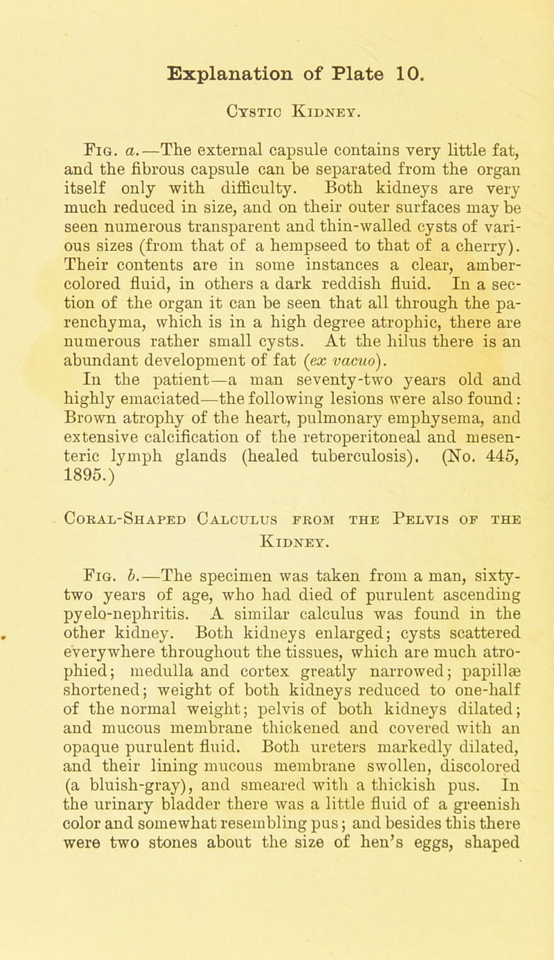 Cystic Kidney. Fig. a.—The external capsule contains very little fat, and the fibrous capsule can be separated from the organ itself only with difficulty. Both kidneys are very much reduced in size, and on their outer surfaces may be seen numerous transparent and thin-walled cysts of vari- ous sizes (from that of a hempseed to that of a cherry). Their contents are in some instances a clear, amber- colored fluid, in others a dark reddish fluid. In a sec- tion of the organ it can be seen that all through the pa- renchyma, which is in a high degree atrophic, there are numerous rather small cysts. At the liilus there is an abundant development of fat (ex vacuo). In the patient—a man seventy-two years old and highly emaciated—the following lesions were also found: Brown atrophy of the heart, pulmonary emphysema, and extensive calcification of the retroperitoneal and mesen- teric lymph glands (healed tuberculosis). (No. 445, 1895.) Coral-Shaped Calculus from the Pelvis of the Kidney. Fig. b.— The specimen was taken from a man, sixty- two years of age, who had died of purulent ascending pyelo-nephritis. A similar calculus was found in the other kidney. Both kidneys enlarged; cysts scattered everywhere throughout the tissues, which are much atro- phied; medulla and cortex greatly narrowed; papillm shortened; weight of both kidneys reduced to one-half of the normal weight; pelvis of both kidneys dilated; and mucous membrane thickened and covered with an opaque purulent fluid. Both ureters markedly dilated, and their lining mucous membrane swollen, discolored (a bluish-gray), and smeared with a thickisli pus. In the urinary bladder there was a little fluid of a greenish color and somewhat resembling pus; and besides this there were two stones about the size of hen’s eggs, shaped