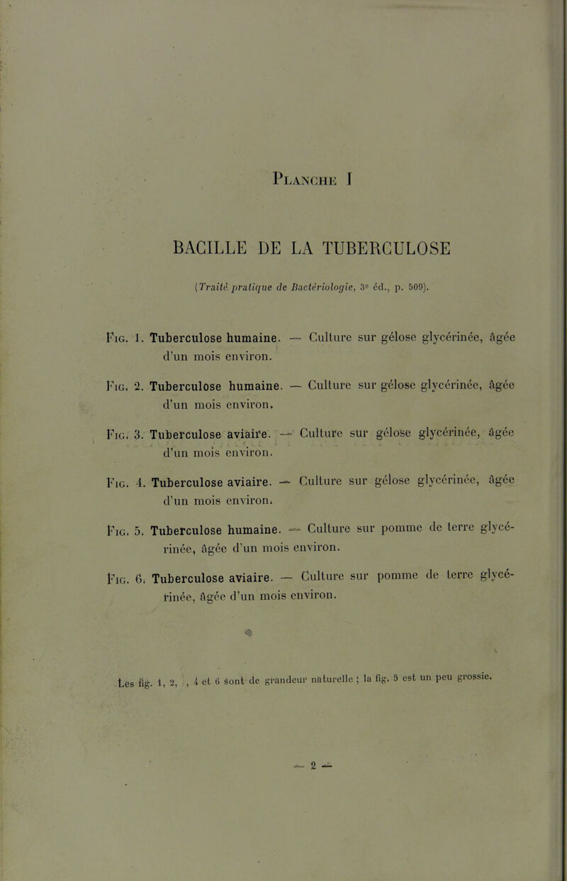 BACILLE DE LA TUBERCULOSE {Traité pralique de Bactériolocjie, 3c éd., p. 509). iG. 1. Tuberculose humaine. — Culture sur gélose glycérinée, âgée d'un mois environ. iG. 2. Tuberculose humaine. — Culture sur gélose glycérinée, âgée d'un mois environ. iG. 3. Tuberculose aviaire. — Culture sur gélose glycérinée, âgée d'un mois environ. FiG. 4. Tuberculose aviaire. — Culture sur gélose glycérinée, âgée d'un mois environ. PiG. 5. Tuberculose humaine. — Culture sur pomme de terre glycé- rinée, âgée d'un mois environ. FiG. 6; Tuberculose aviaire. — Culture sur pomme de terre glycé- rinée, âgée d'un mois environ. <9 tes iig. 1,2, , 4 et 6 éont de grandeui' naturelle ; la fig; 5 est uti peu grossie.