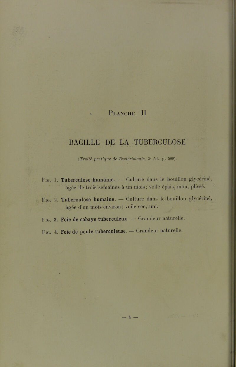 BACILLE DE LA TUBERCULOSE {Traité pratique de Bactériologie, 3 éd., p. 509). FiG. 1. Tuberculose humaine. — Culture daus le bouillon glycérine, âgée de trois semaines à un mois; voile épais, mou, plissé. FiG. 2. Tuberculose humaine. — Culture dans le bouillon glycériné, âgée d'un mois environ; voile sec, uni. FiG. 3. Foie de cobaye tuberculeux. — Grandeur naturelle. FiG. 4. Foie de poule tuberculeuse. — Grandeur naturelle.